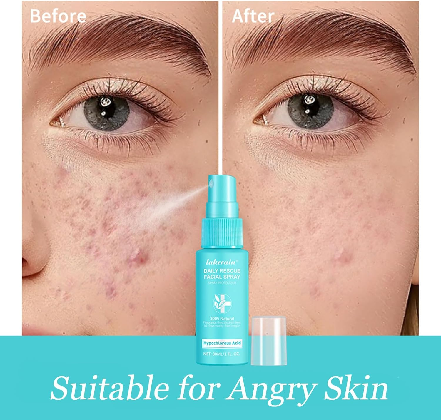 Hypochlorous Acid Face and Skin Spray,Safe for Use on Acne Prone Skin/Eczema/Dry Scalp/Post Procedure/Toner/Eye Lash/Face and Hand Cleanser image number 5