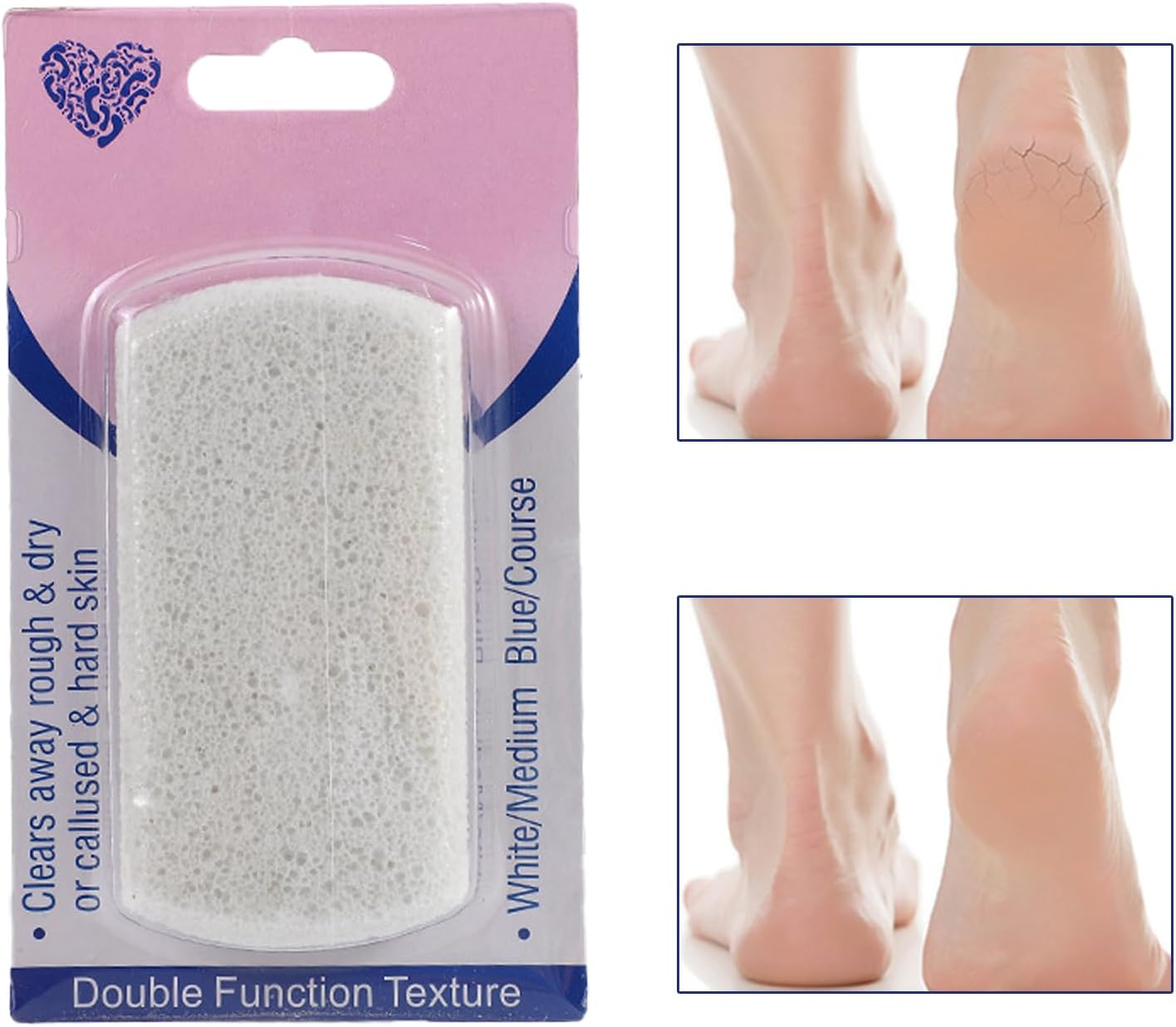 Pumice Stone for Feet,Double-Sided Design Foot Scrubber Pumice | Massaging Foot Stone, Effective Foot Scrubber for Hands, Palm, Dry Dead Skin Pochy - Gray image number 3