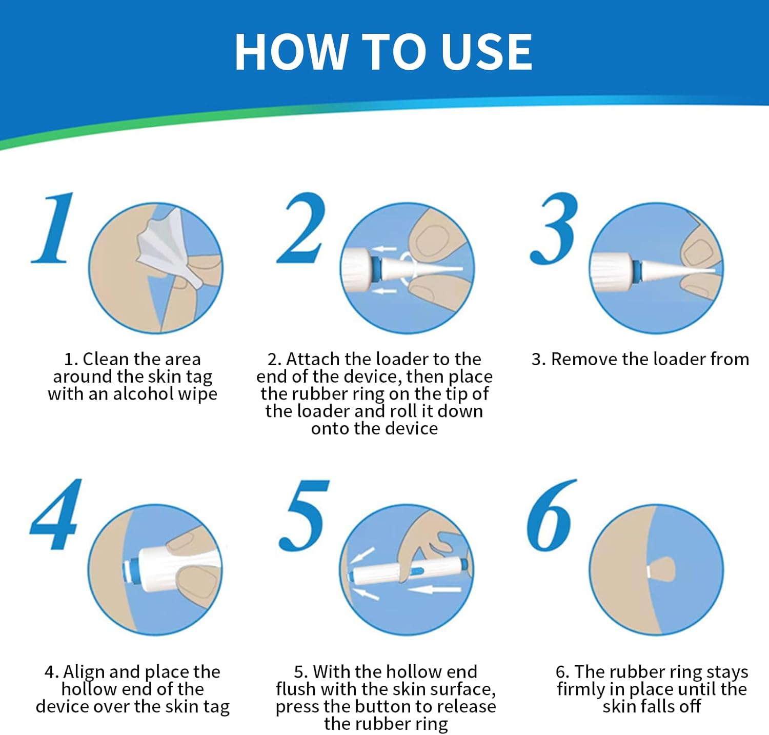 1 Pack Skin Tag, Removes Moles from Face and Body, Safely and Painlessly of Mole Remover Kitfast-Acting Skin Tag Remover, Effective Mole Remover, Precision Applicator for Smooth Skin