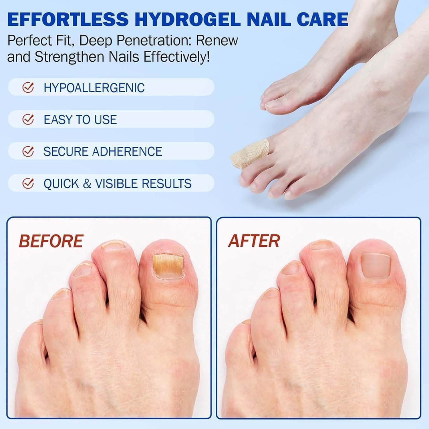 Fungal Nail Patches for Toenails, Nail Health Care Patches, Overnight Toe Nail Treatments for Damaged Nails Foot Nails Repair and Care image number 6