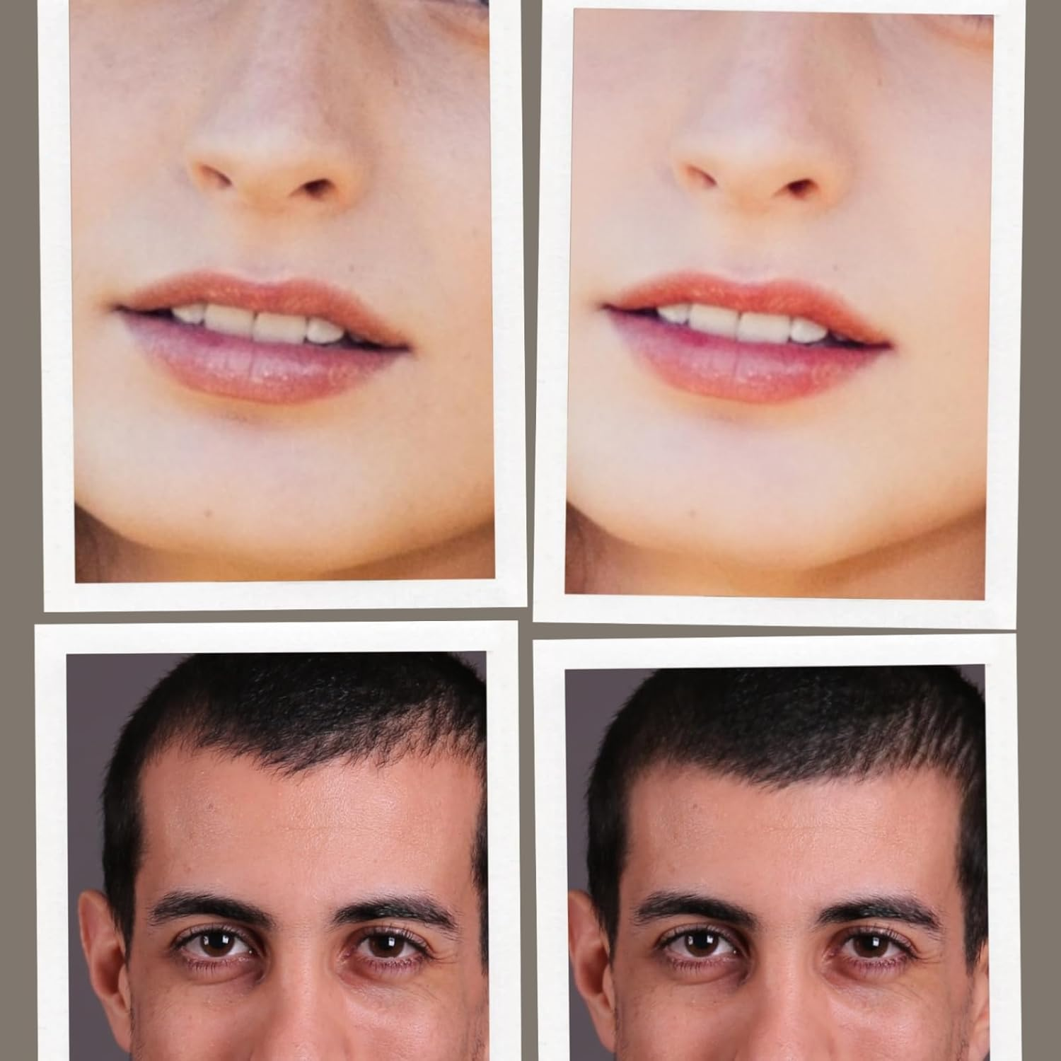 Microneedle Derma Roller Pen - Professional Microneeding 0.25 Mm Derma Roller Beauty Pen - Microneedles Roller Pen for Women Men Tools (Purple) image number 2