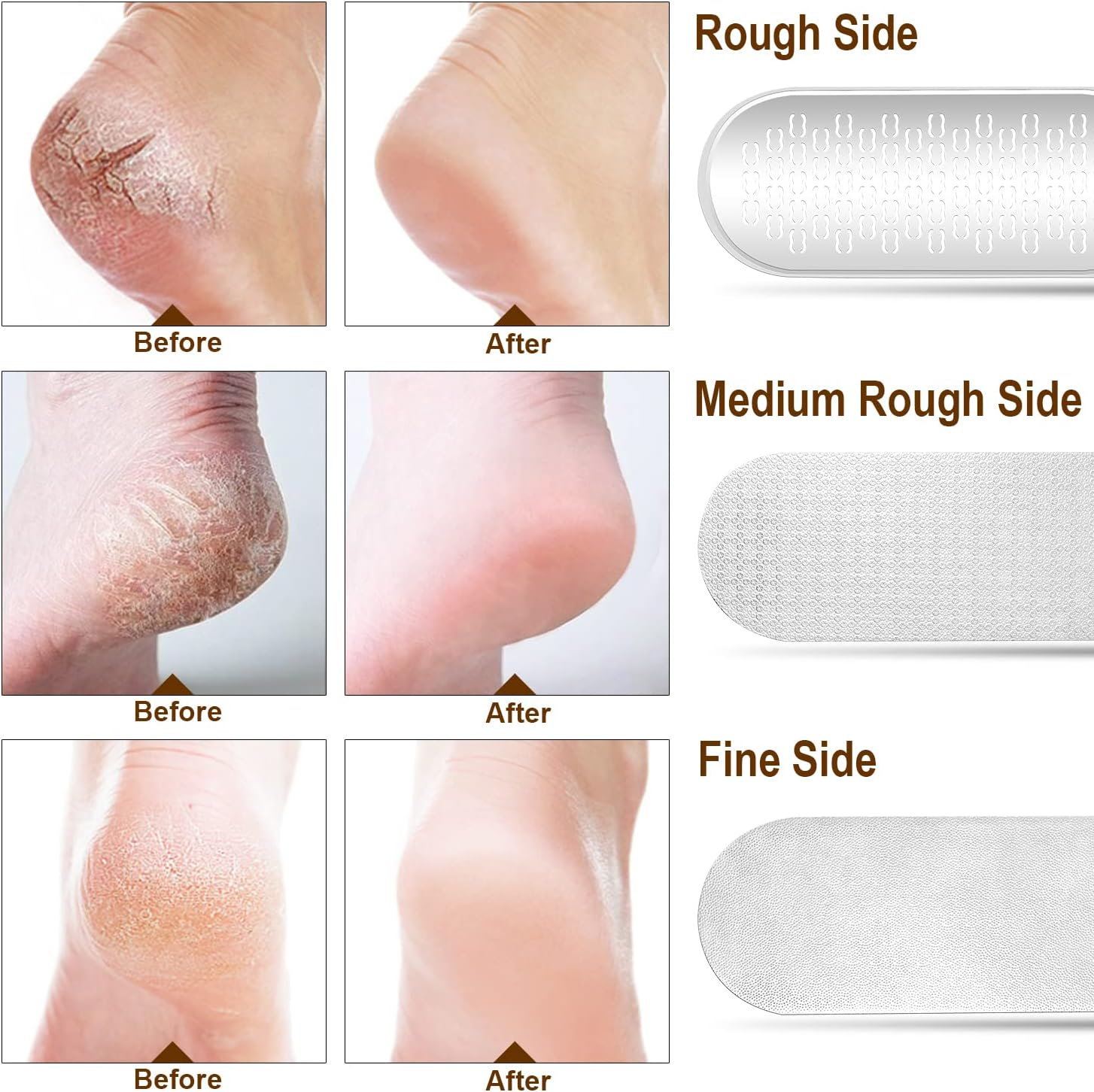 Foot File Callus Remover, 3-In-1 Stainless Steel Foot Scraper for Pedicure, Foot Rasp Callus Remover for Callus Removal, Cracked Feet, Foot Care (Champagne-F6D) image number 1