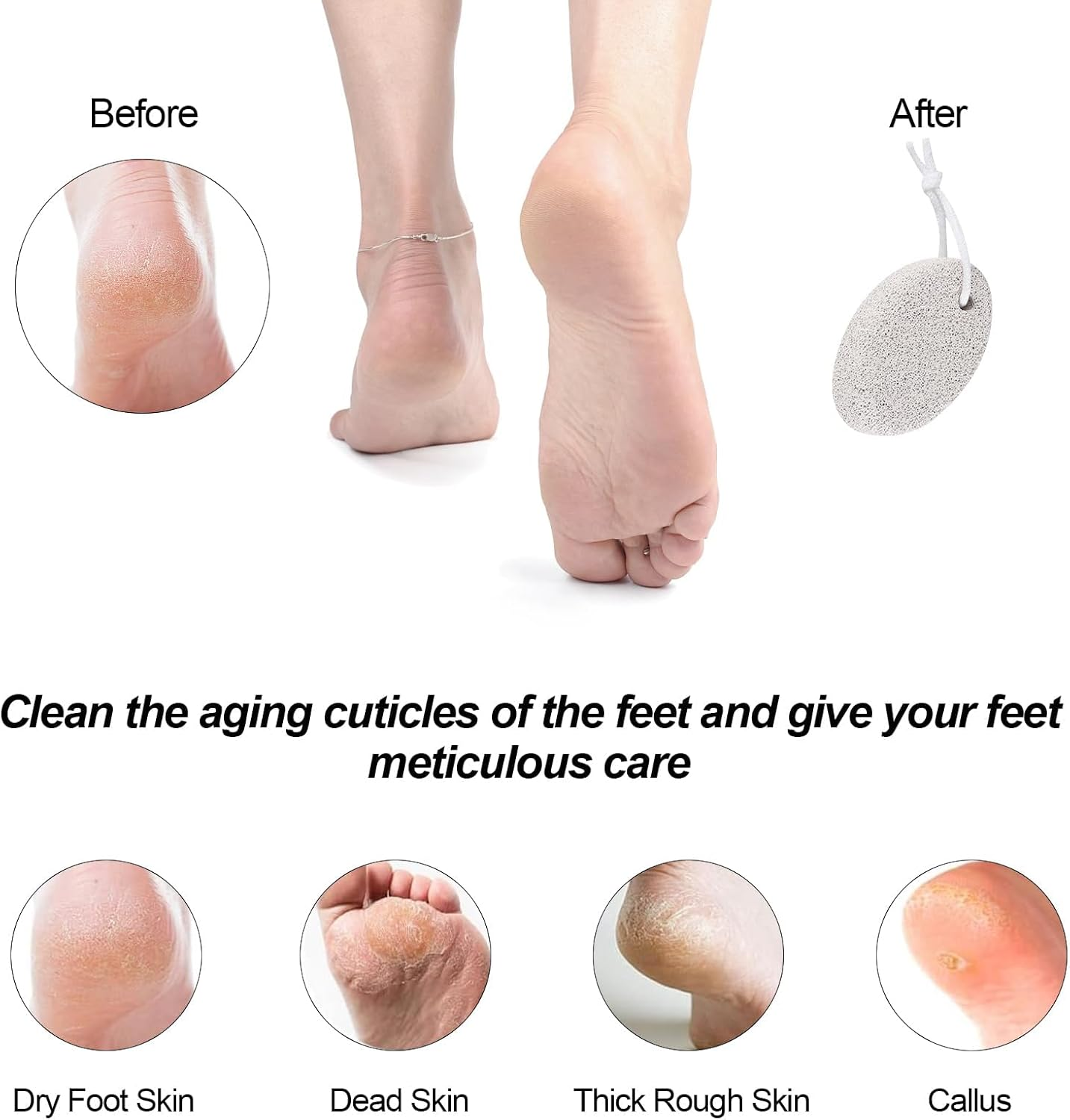 Vervesourced 2PCS Natural Pumice Stone for Feet, Vervesourced Lava Pedicure Tools Hard Skin Callus Remover for Men/Women Feet and Hands - Natural Foot File Exfoliation to Remove Dead Skin image number 5