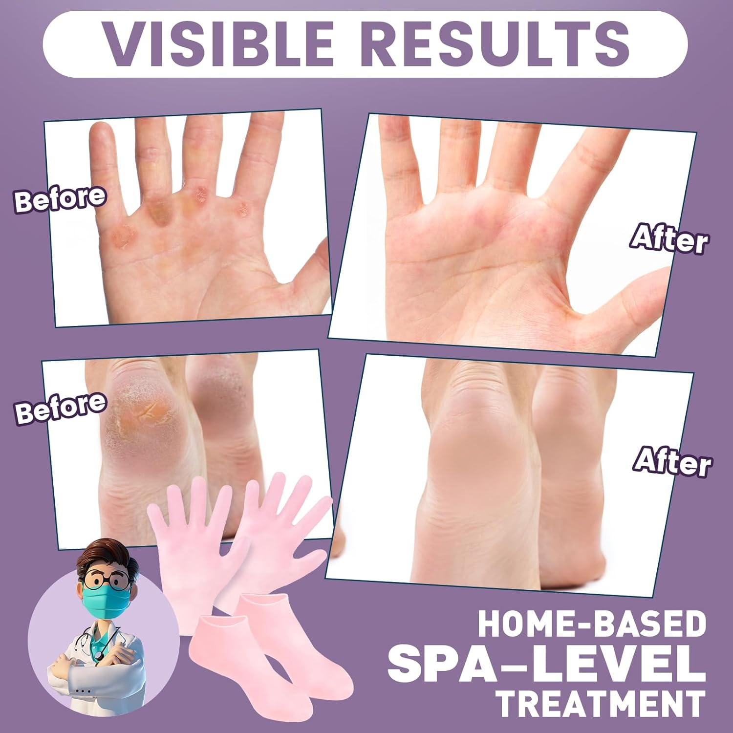 TEAWOO 2 Pairs Silicone Socks Gloves Set for Dry Cracked Feet Hands, Silicone Moisturizing Socks for Women, Hand Foot Care, Spa Gel Socks Gloves after Pedicure (Socks Fits up to Size 10) image number 3