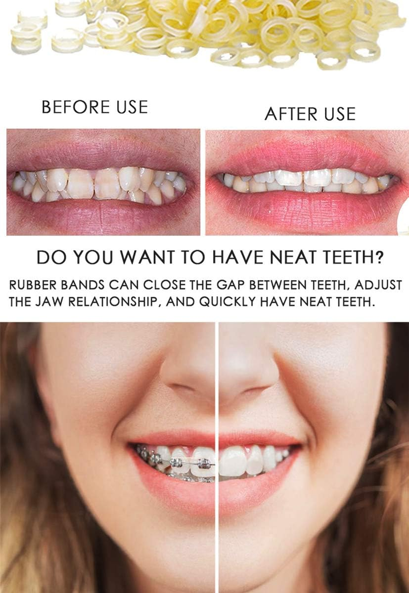 RZJZGZ 5 Packs (500 Pcs) Orthodontic Elastic Bands Dental Orthodontic Elastics Latex Rubber Bands(Fox 1/4")