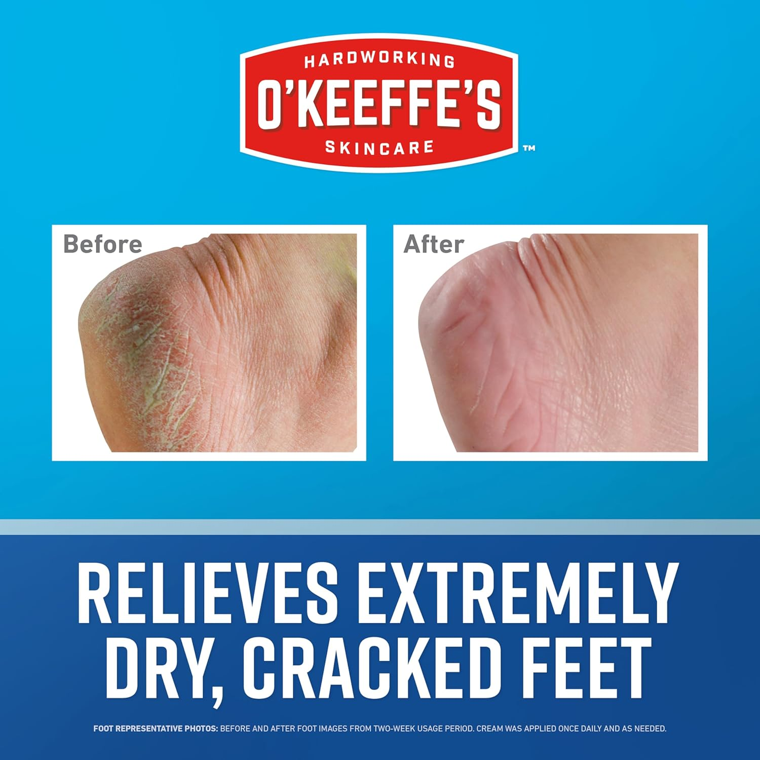 O'Keeffe'S Healthy Feet Cream 76G Jar - Foot Cream Relieves & Repairs Extremely Dry, Cracked Feet. Guaranteed Relief. Tough on Dryness, Gentle on Sensitive Skin. Non-Greasy, Unscented image number 4