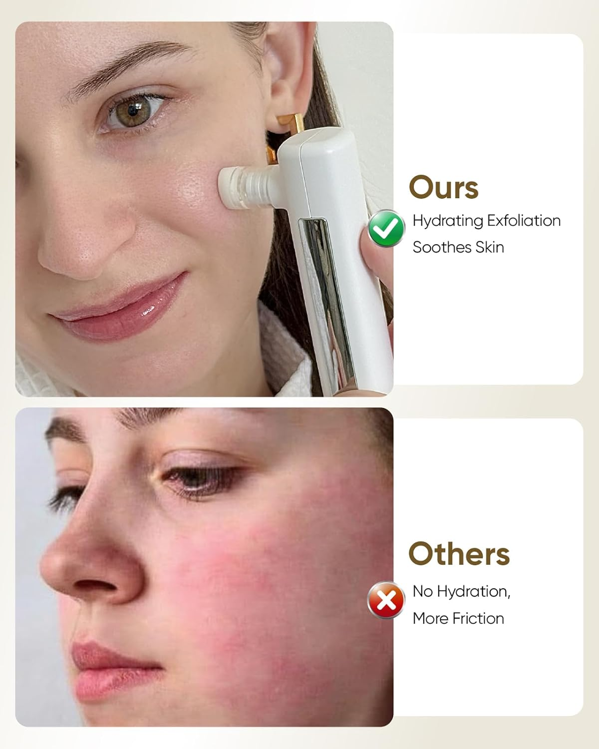 Kingdo 4-In-1 Microdermabrasion Machine Professional-Gentle Exfoliator, Hydrating Mist, Pore Vacuum & LED Mirror-At-Home Spa Beauty Device for Sensitive Skin image number 5