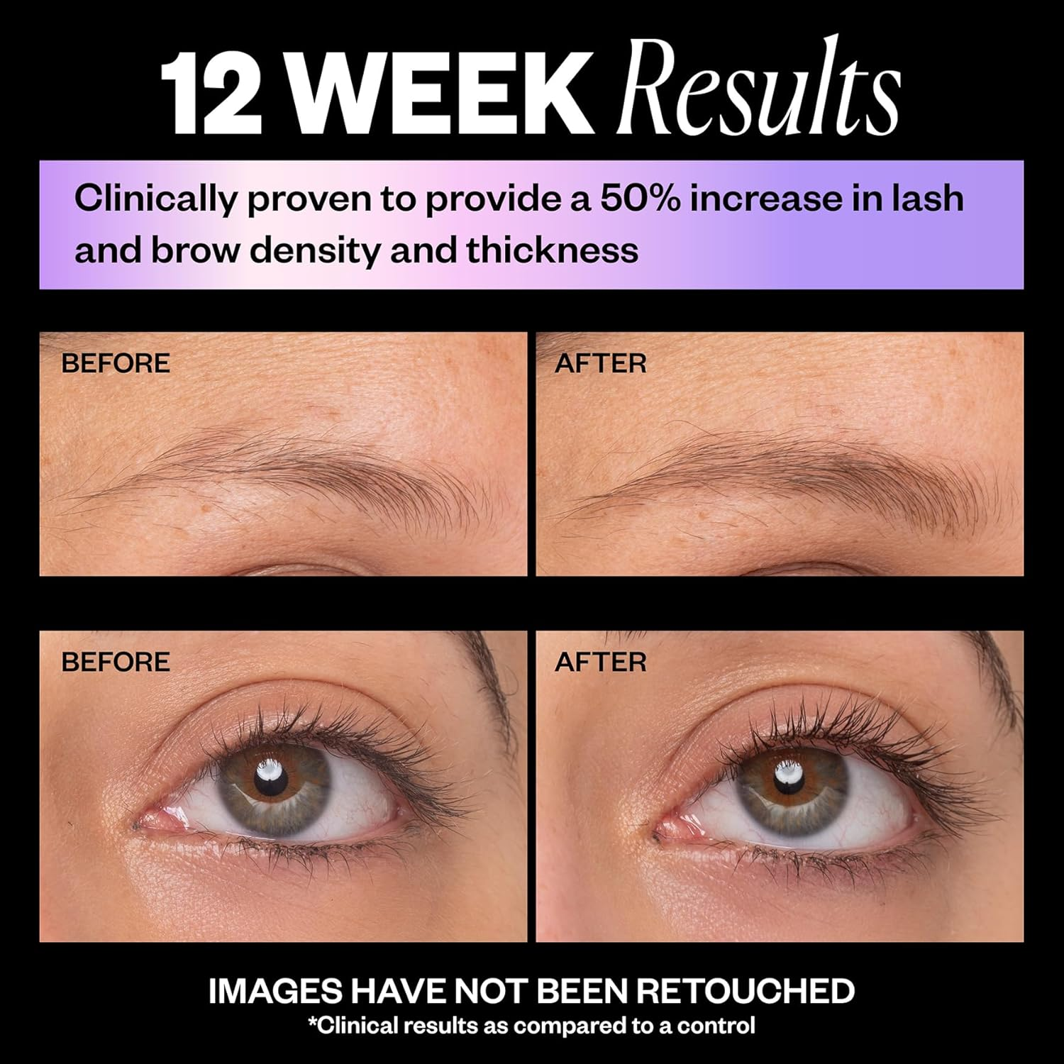 IGK Look Out Lash and Brow Boosting Peptide Serum | Increases Thickness + Fullness + Density of Brows and Lashes | Dermatologist + Ophthalmologist Approved | Vegan + Cruelty-Free | 0.11 Fl Oz image number 1