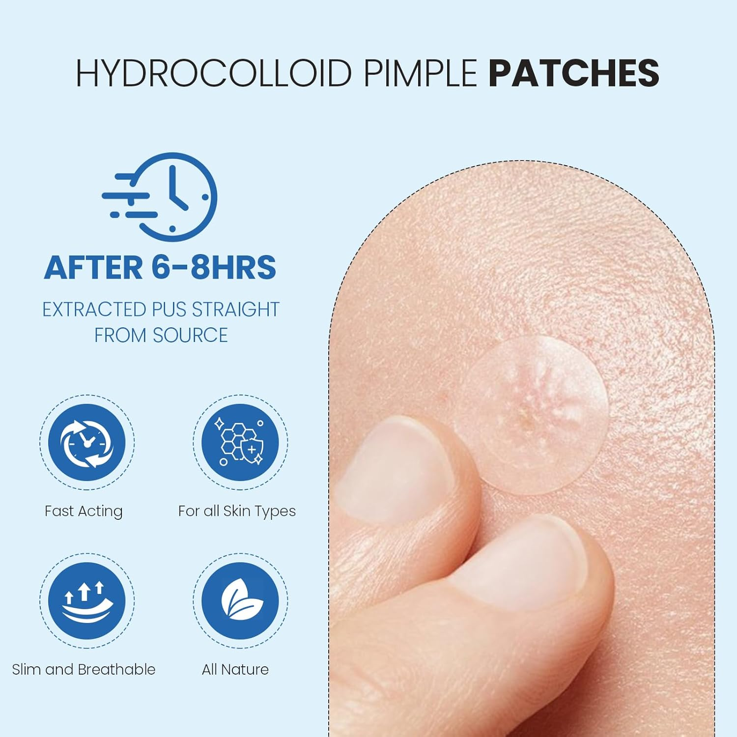 240 Counts Pimple Patches for Face, Hydrocolloid Acne Patches Pimple Patch Invisible Pimple Patch Zit Patches for Face Acne Patch Blemish Patches Zit Stickers for Skin Care image number 1