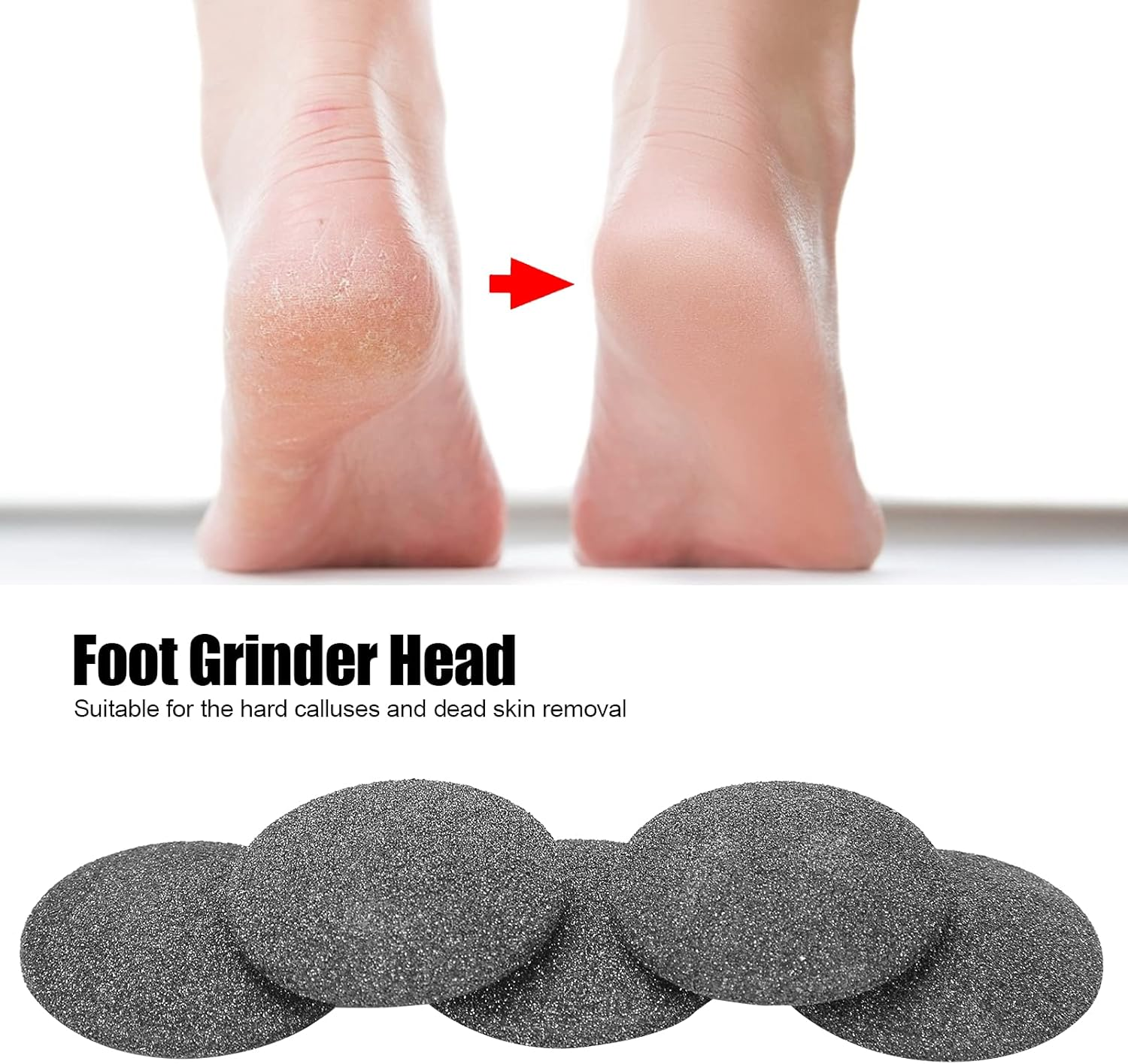 Watris Veiyi Replacement Sandpaper Discs, Pack of 5 Callus Remover Hard Skin Replacement Foot Grinding Head Tool for Dead Skin Callus Remover Head Foot Files (Black) image number 2