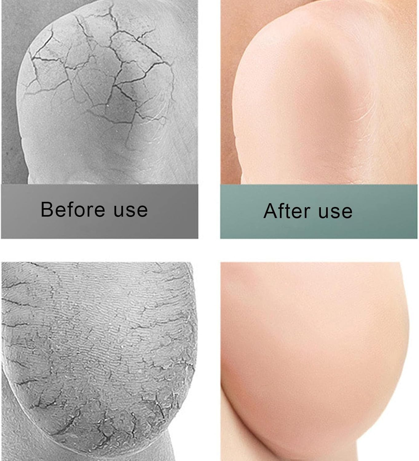 Heel Socks for Dry Cracked Feet, Moisturizing Toeless Sock for Foot Care, Gel Heel Socks for Dry Cracked Feet, Gel Heel Repair Socks for Cracked Heels, Moisture Socks for Dry Feet Puchen image number 2