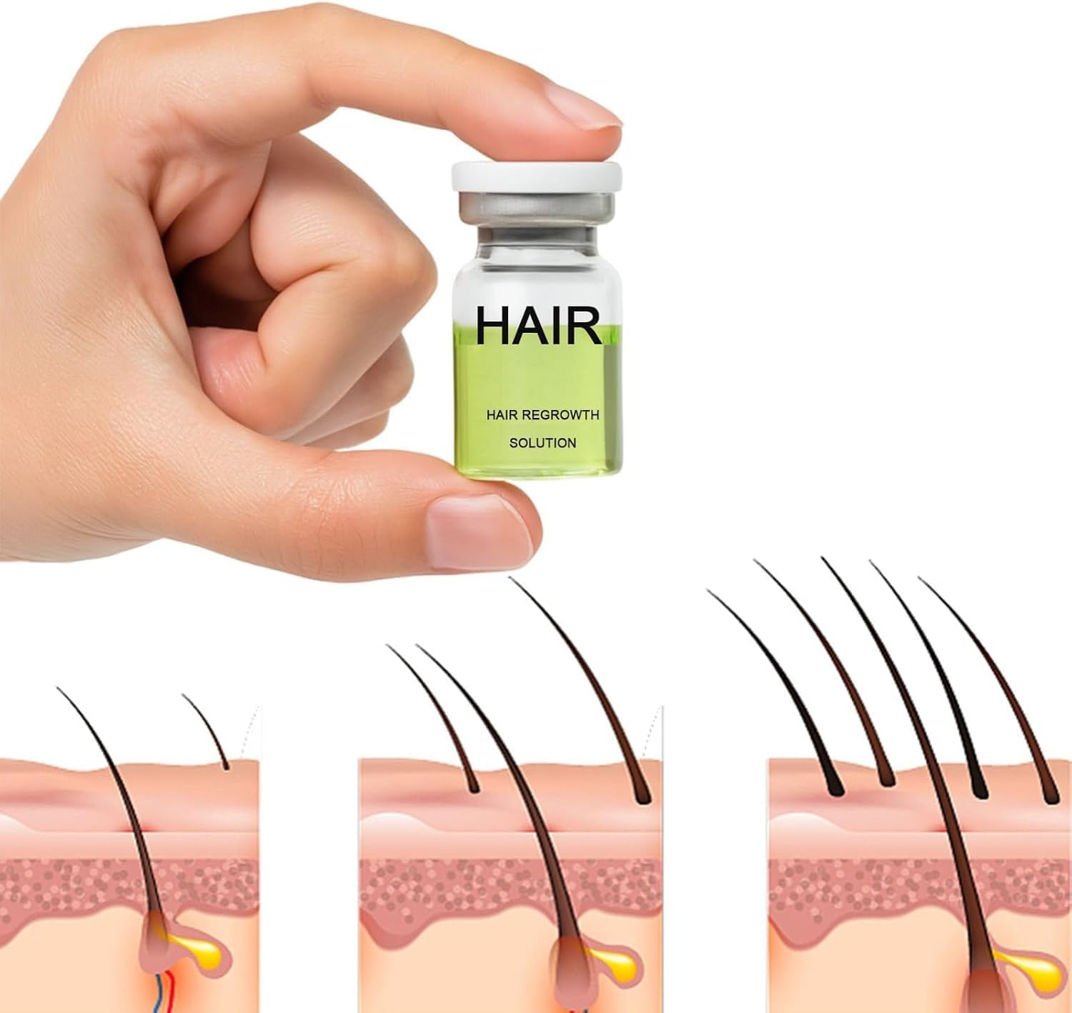 Alphainfuse Hair Regrowth System, Advanced Hair Growth Treatment, Gentle Painless, Strengthens Roots for Men and Women (2Pcs) image number 4