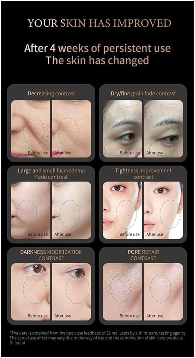 Domoi Radio Frequency Spa Machine Wrinkle Removal Skin Face Tightening Beauty Care Device Collagen Easy to Use Gold image number 5