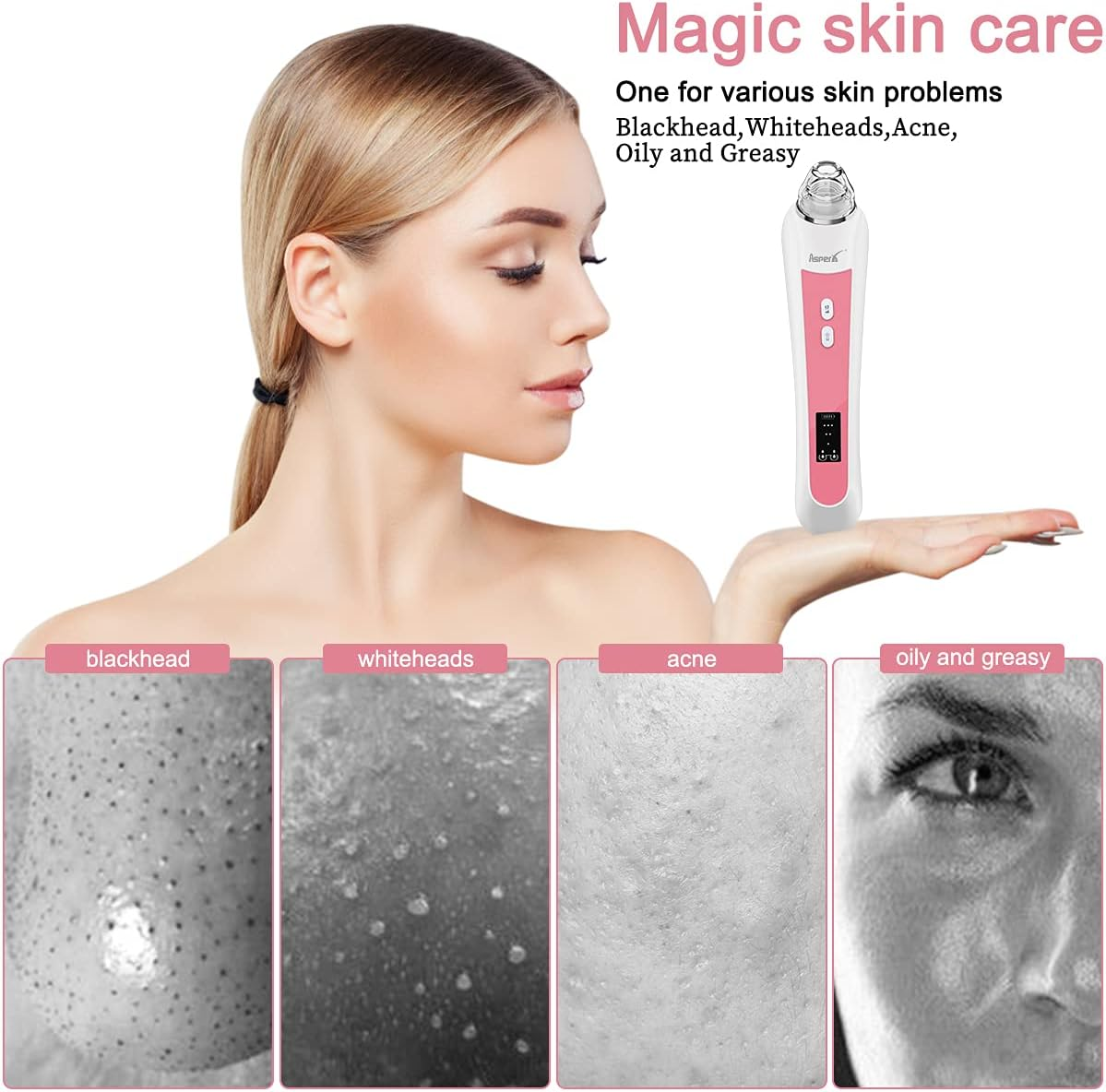 Blackhead Vacuum, Asperx 5.0 Megapixels Visible Blackhead Remover Facial Pore Vacuum, 20X Microscope Blackhead Suction Tool, Rechargeable Suction Facial Pore Cleaner with 6 Replaceable Tips(Upgraded) image number 6