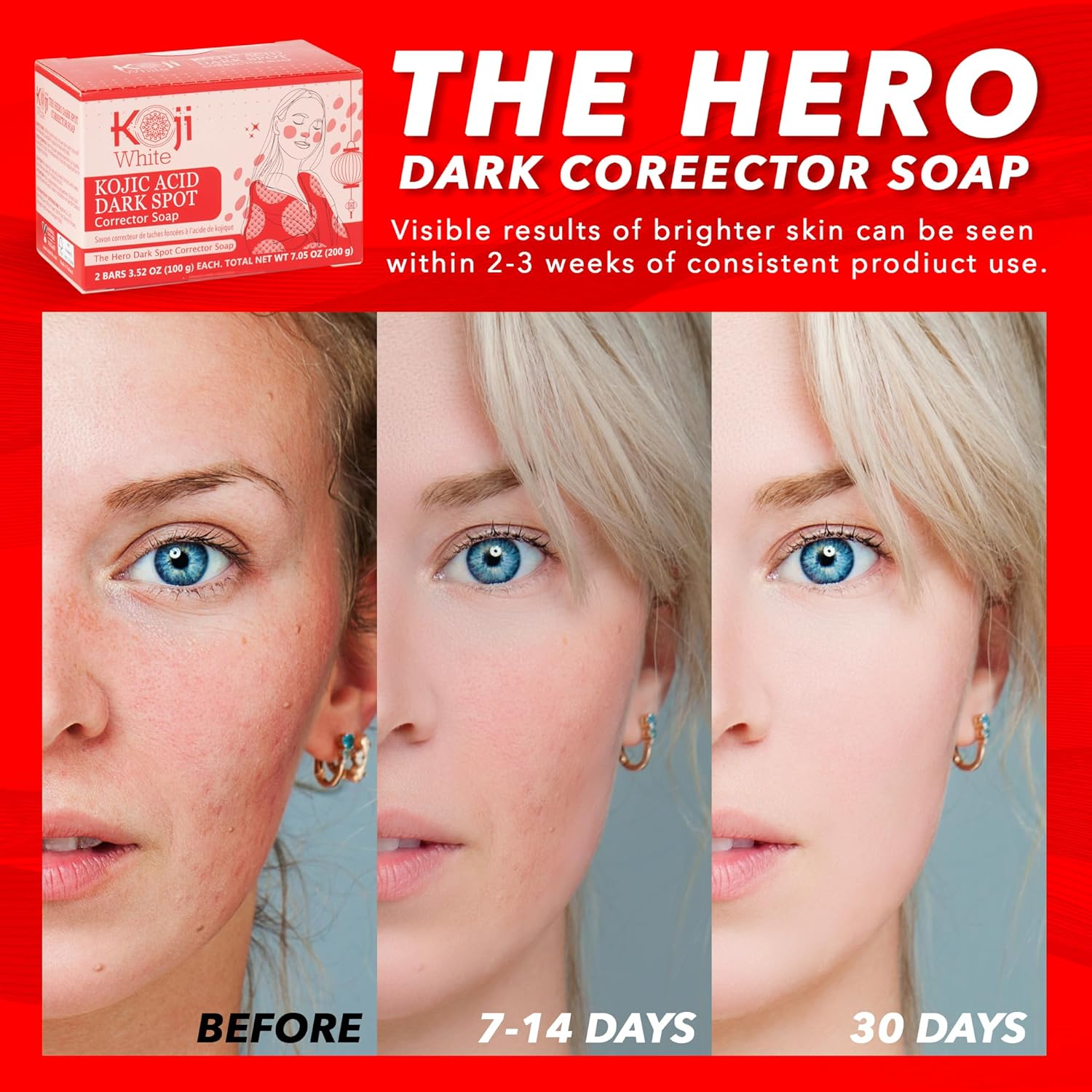 Koji White 4% Kojic Acid Dark Spot Corrector Soap for Exfoliating & Moisturizes with Vitamin C, Licorice Root Extract, Hydrating & Even Skin Tone Cleansing Bar for Face & Body, Vegan, 3.52 Oz (2 Bars) image number 5