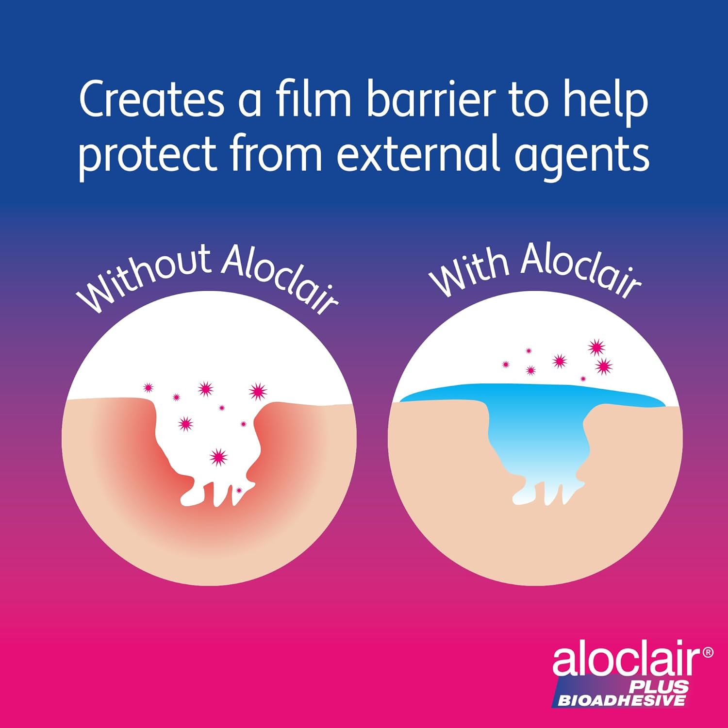 Aloclair 8 Ml Mouth Ulcer Treatment Gel image number 6