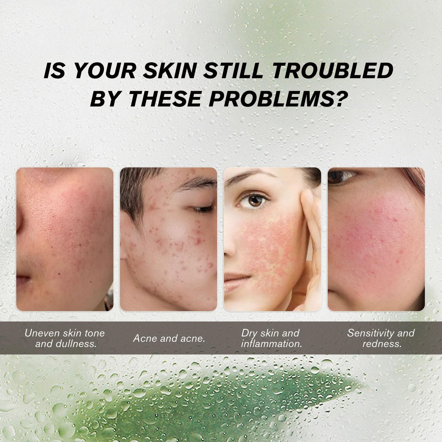 10% Azelaic Acid + Hyaluronic Acid Calming Serum - a Gentle Facial Serum for Sensitive Skin, Formulated with Hyaluronic Acid to Help Soothe Skin, Vegan-Friendly, 30Ml【Not Aunaxxx Brand】 image number 4