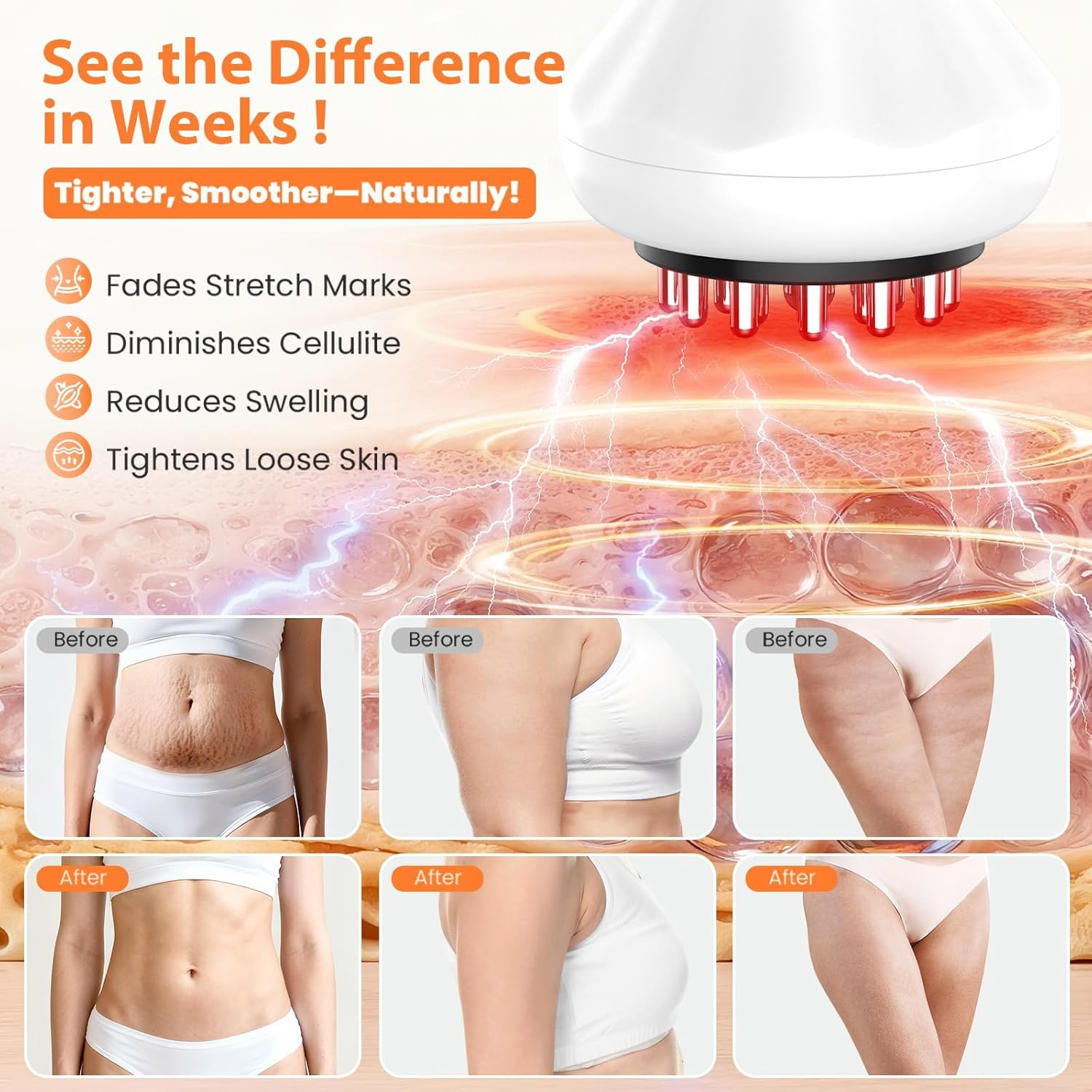 Body Sculpting Machine, Lymphatic Drainage Massager & anti Cellulite Massage Tool, Helps Reduce Stretch Marks & Cellulite, Pain Relief Devices for Sciatica Nerve, Legs, Arms, Hip, Muscle & Lower Back