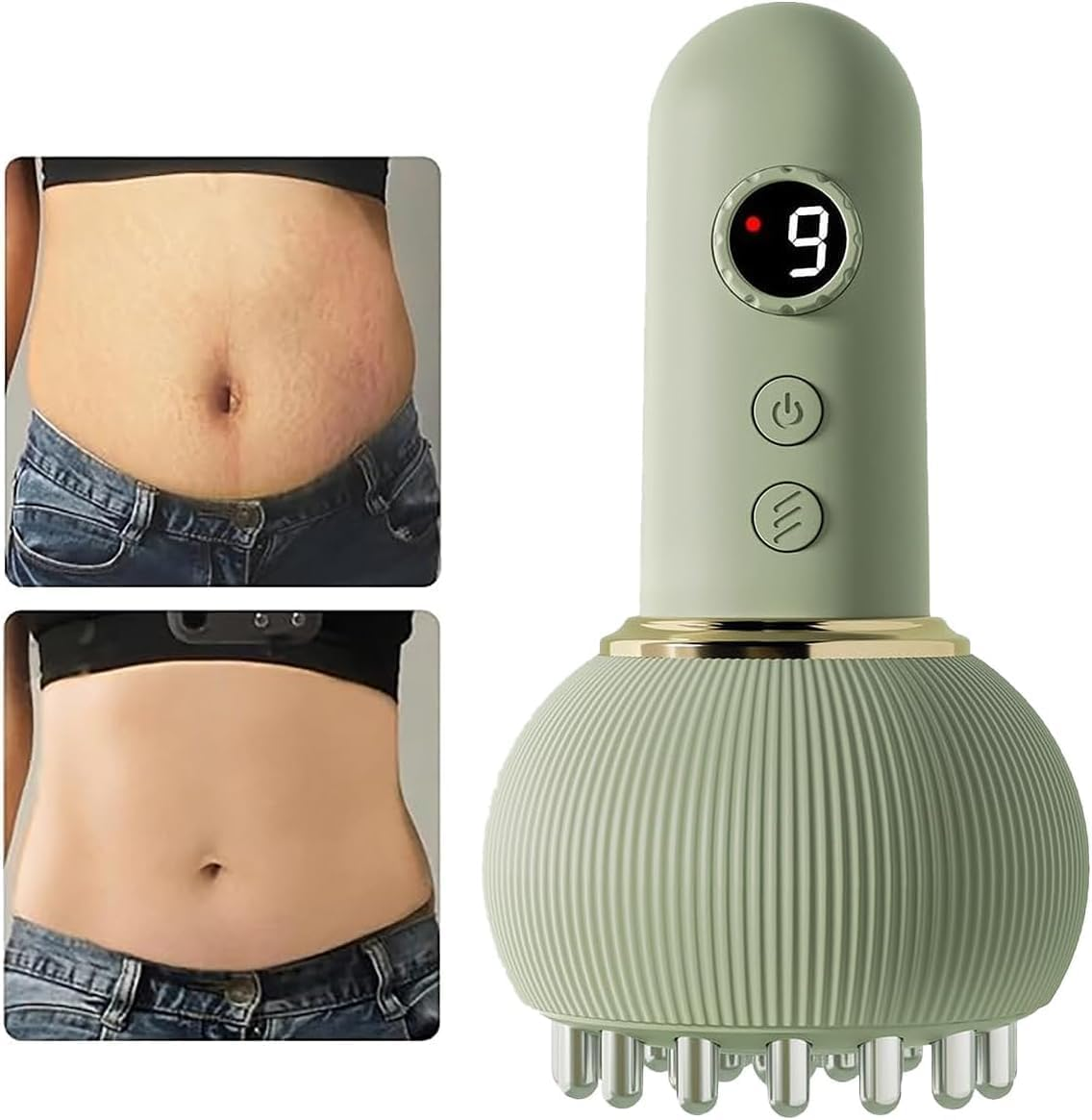 Lymphatic Drainage Massager, anti Cellulite Massage Tool, USB Charging Helps Reduce Stretch Marks Cellulite, for Legs, Arms, Belly, Body Sculpting Machine with Microcurrent, Light, Heat Vibration (White)