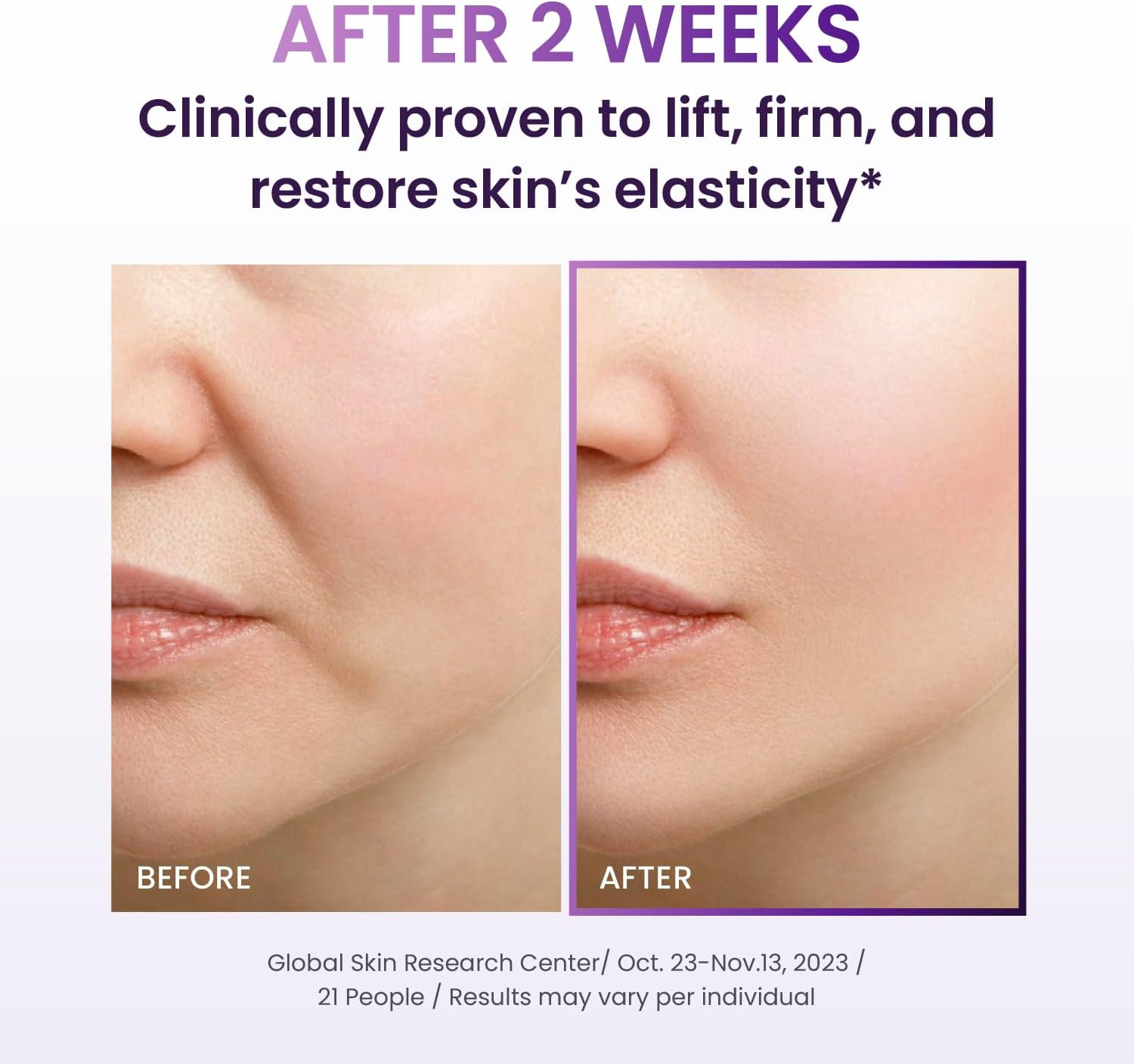 BIOHEAL BOH Probioderm 3D Lifting Cream 1.7 Fl Oz | Advanced Korean Anti-Aging Probiotics Facial Night Cream Moisturizer with 17-Peptide Complex & Patented Probioderm for Wrinkles on Face and Neck image number 6