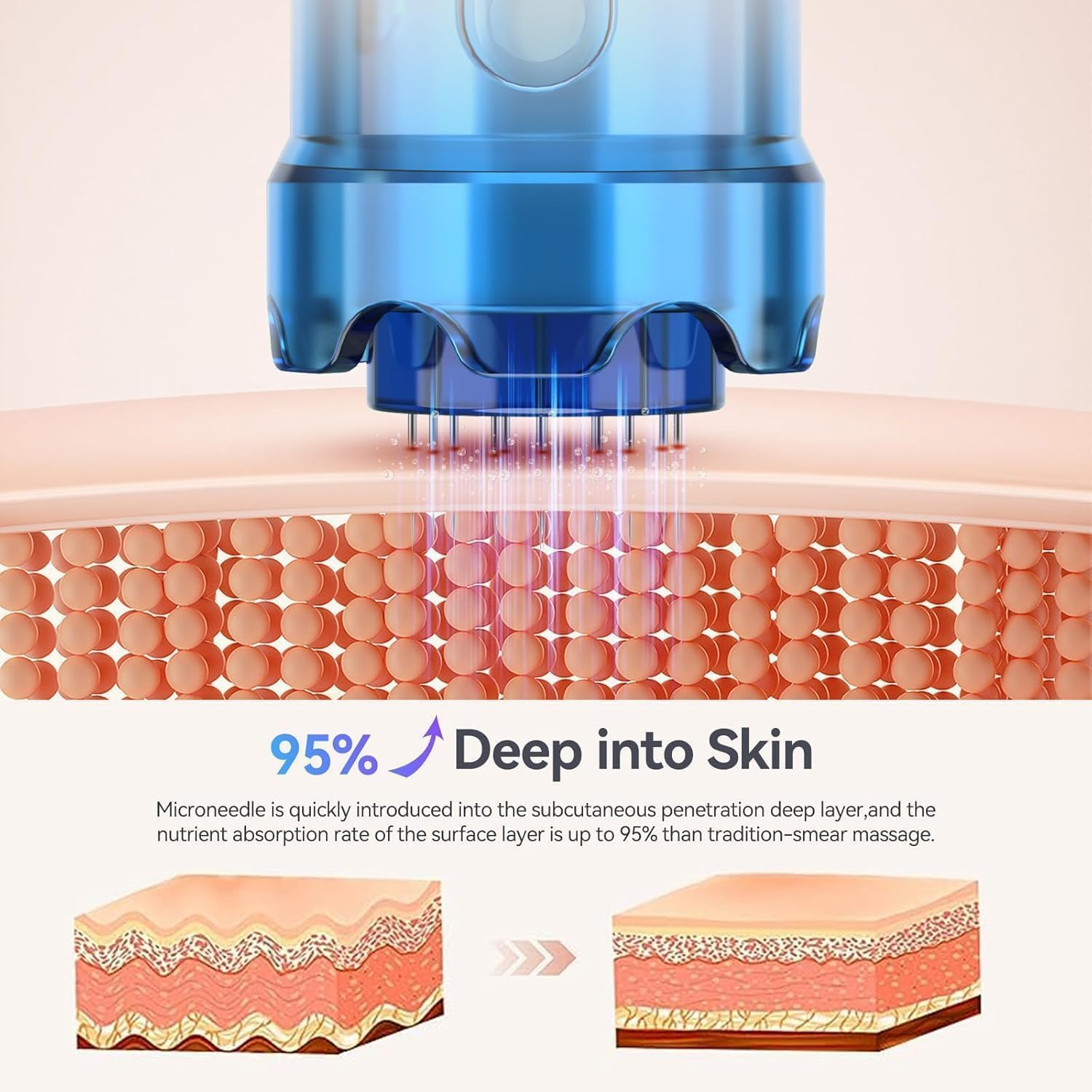 Wesileyern 20Pcs 12PIN Replacement Cartridges Needles, Dermapen Microneedling Needles, Professional Dermapen M8S/A9/ A11 Wireless Derma Roller Pen Needles, for Dermapen M8S/A9/ A11 image number 5