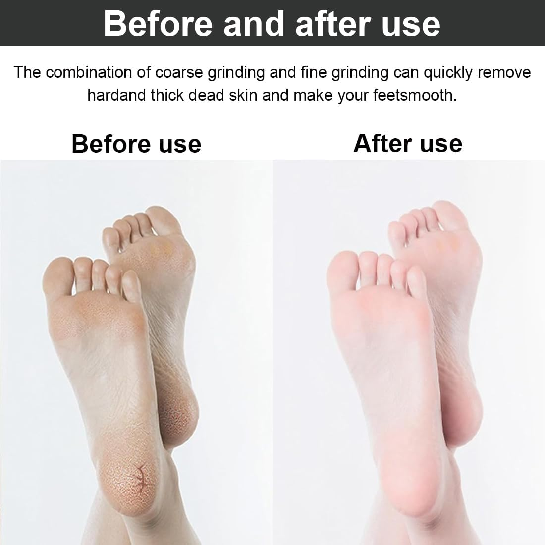 OUDQFCJ Pack of 8 Replacement Rollers, Extra Coarse Refills, Compatible with Scholl Velvet Smooth for Scholl Callus Remover, Pedicure, Foot Care Set for Removing Hard Skin image number 3