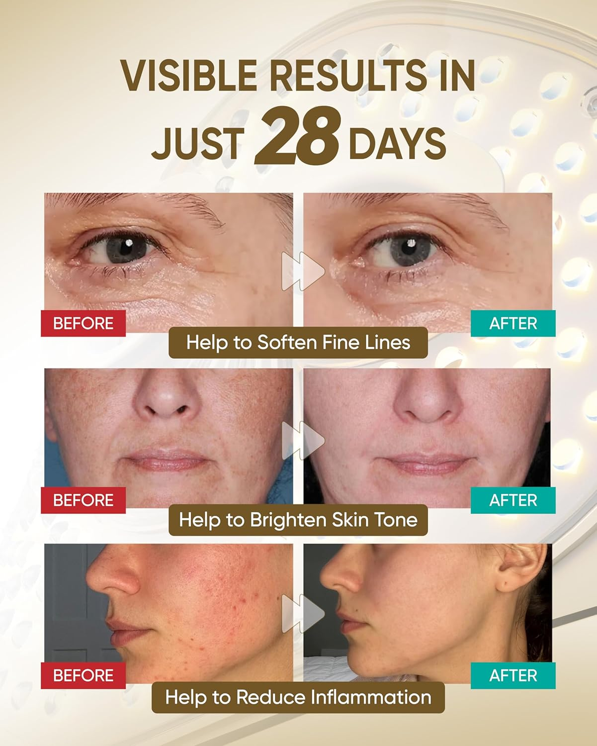 Kingdo Red Light Therapy for Face,7-Colors LED Face Mask with 119 Leds Lens Focusing Technology Near-Infrared 630 Nm & 850 Nm,Light Therapy Mask with Rechargeable Portable Timing Function image number 6