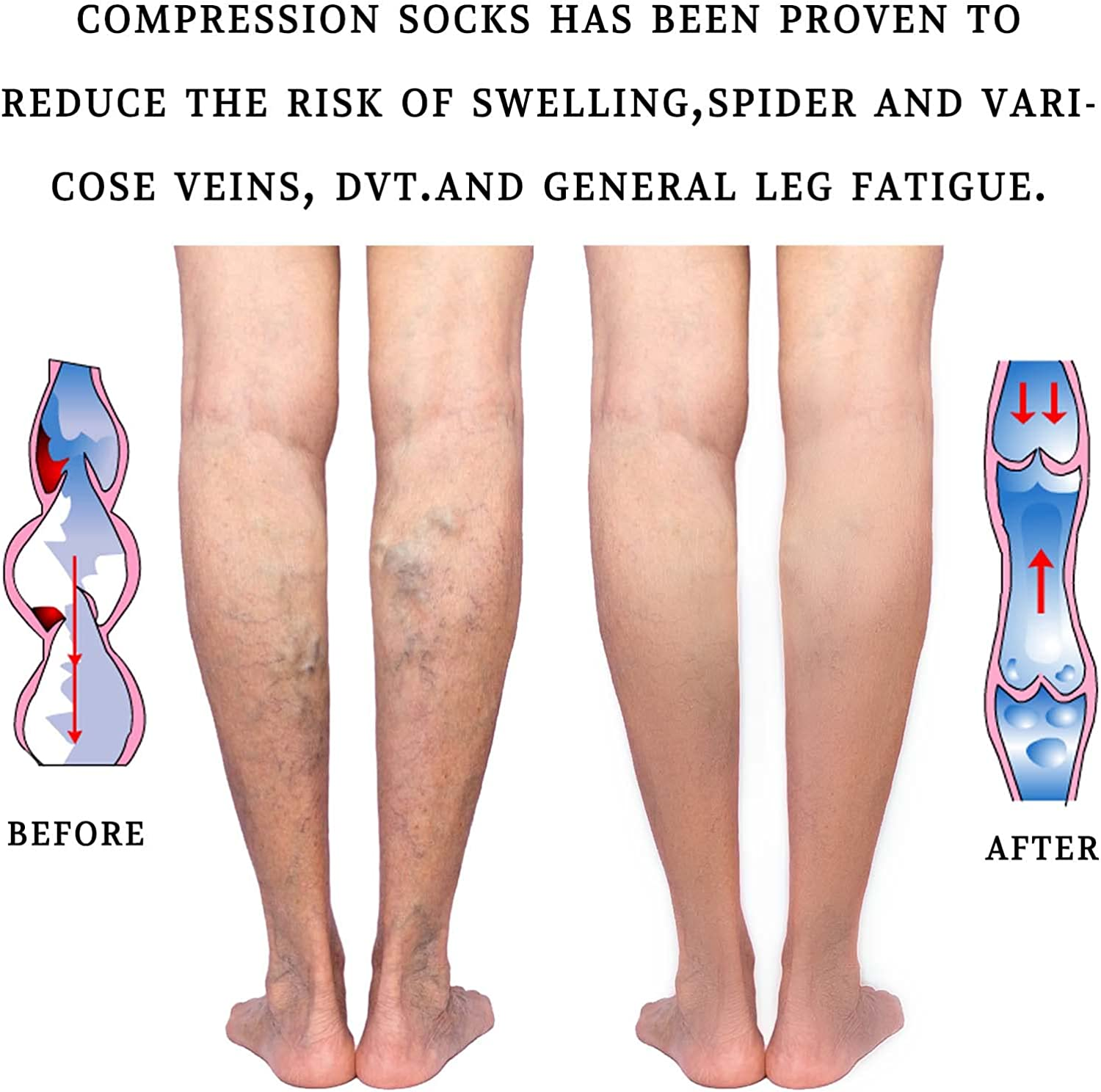 20-30 Mmhg Medical Compression Calf Sleeve for Men and Women （Beige） image number 2