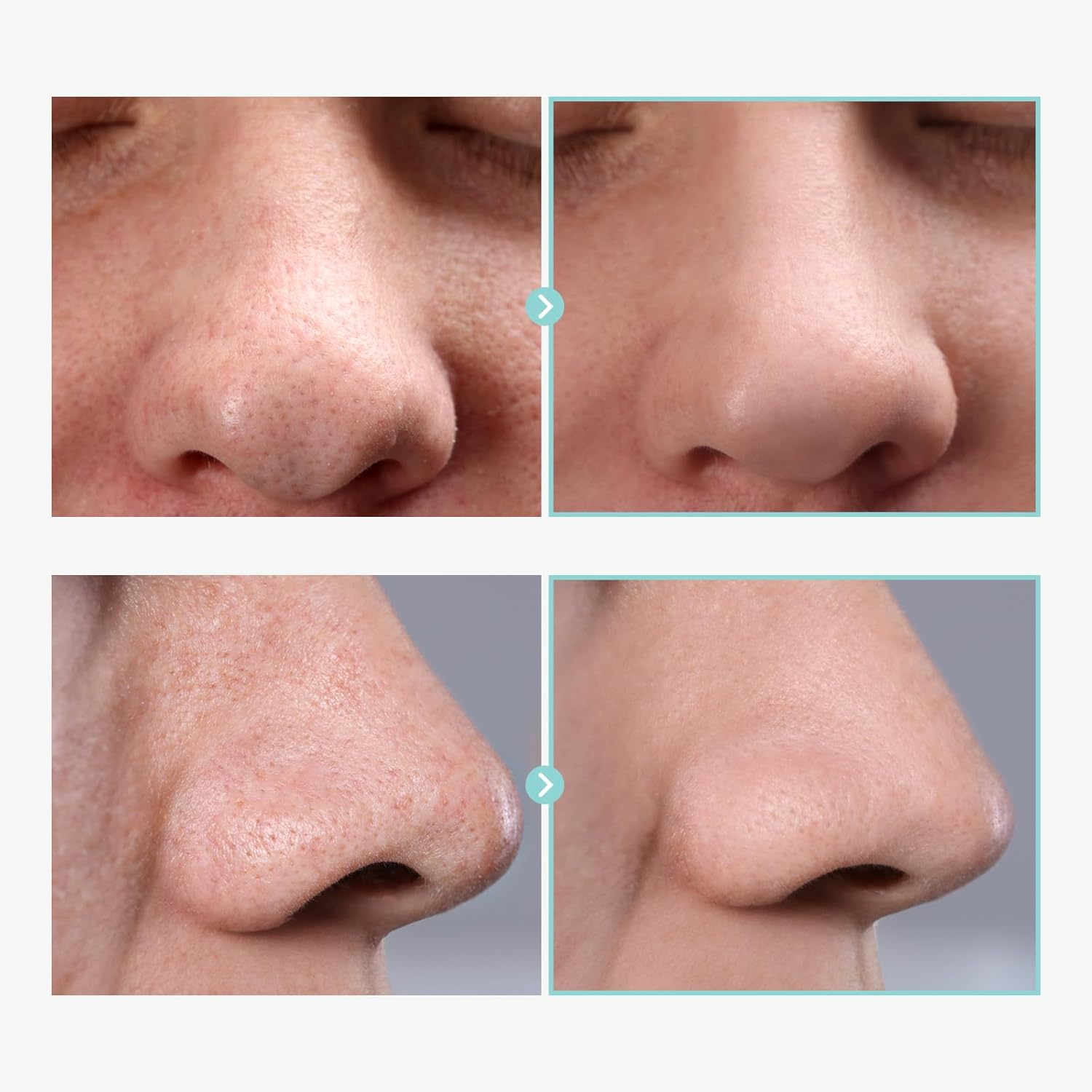 TOSOWOONG Pore Tightening Serum, Instantly Reduces Pores, Smooths Skin & Strengthens Barrier, Formulated with Niacinamide & Allantoin, Pore Minimizer for Face, Korean Skin Care, 30Ml, 1.01 Fl. Oz. image number 3