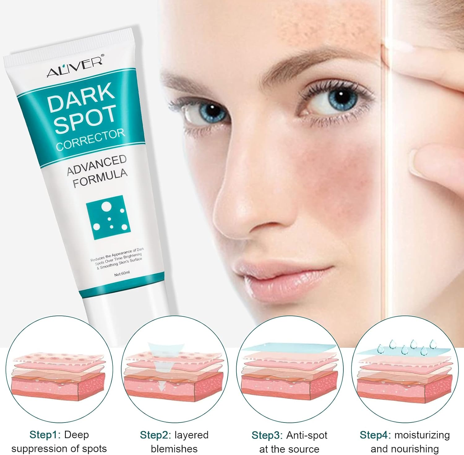 Dark Spot Corrector, Dark Spot Remover for Face and Body, Freckle Remover Cream, Age Spot Remover for Face for Women Men, Evens and Fades Spots with Effective Formula, Suitable for Men and Women image number 5