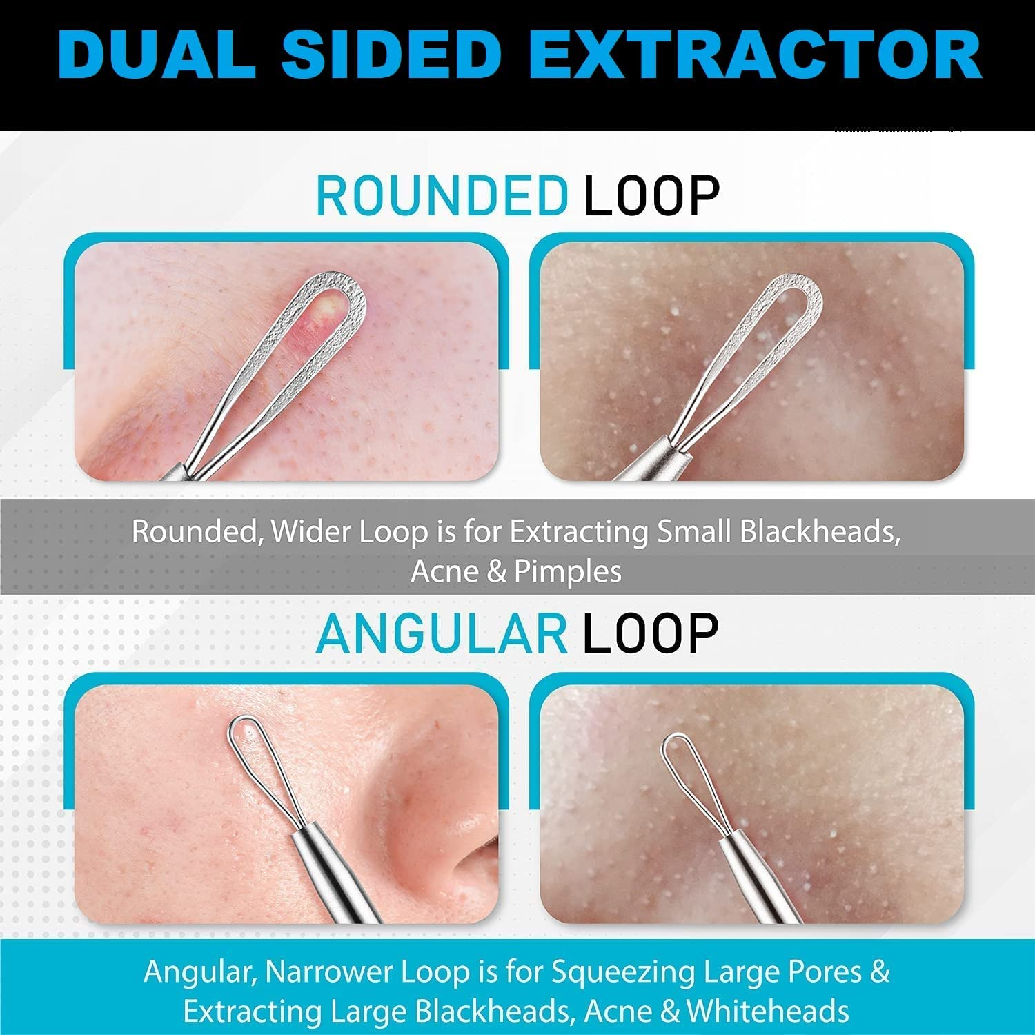 Blackhead Remover Pimple Popper Extractor &ndash; Stainless Steel Acne Removal Kit &ndash; by DMX INTL image number 3