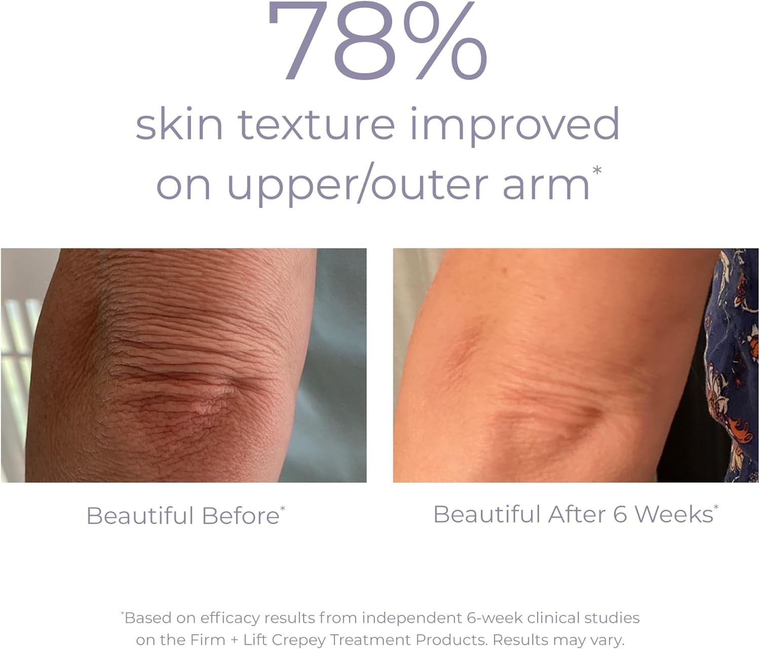 Derma E Crepey Skin Repair Treatment