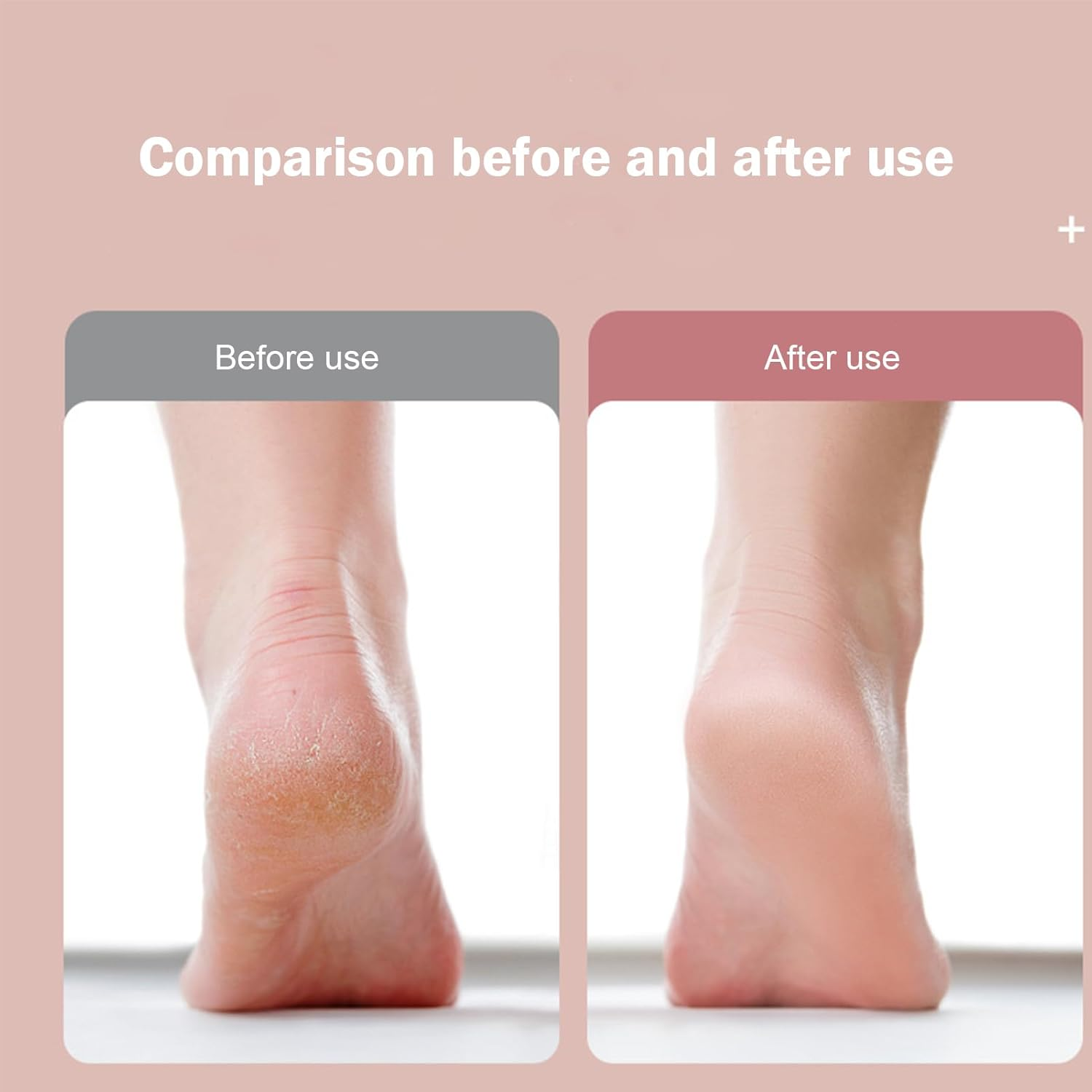 GEUGECY Electric Foot Callus Remover,Electric Callus Remover | Pedicure File - for Men Women Pedicure Heel Foot Spa Salon Removing Dead Skin image number 6