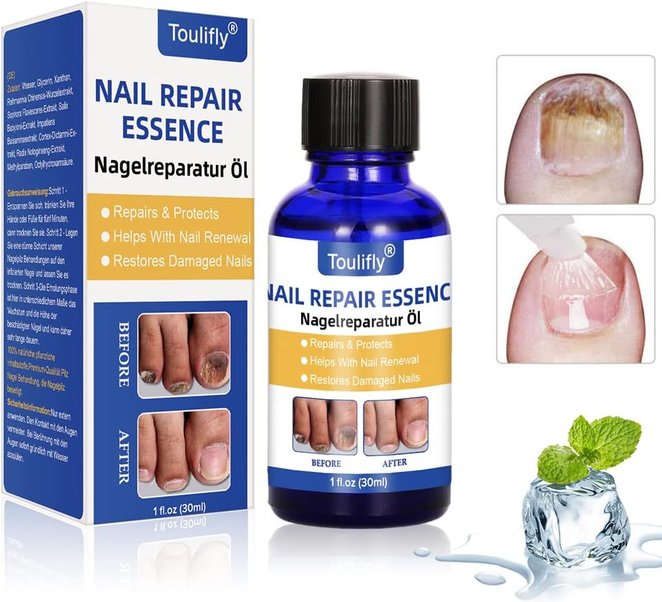 Nail Care and Treatment, Nail Care for Healthy Foot and Hand, Nail Care Oil, Nail Care
