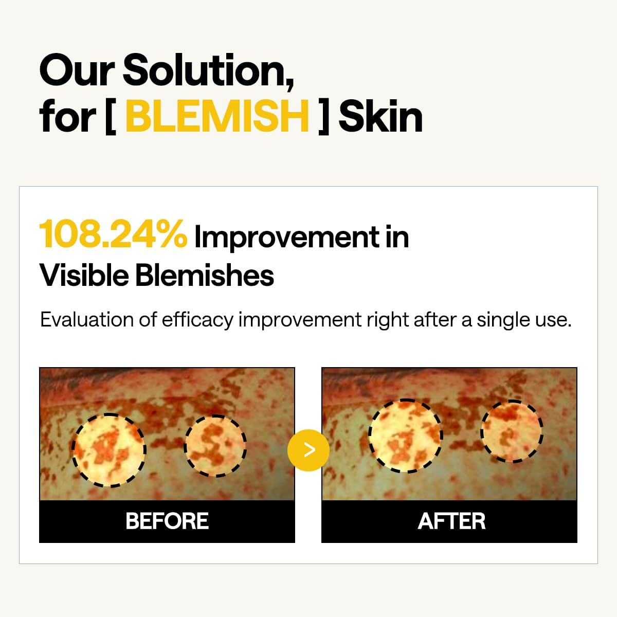 Mediheal Vita Collagen under Eye Patches for - Korean Hydrogel Eye Pads with 7 Vitamin & 5 Micro Collagen. Moisturizng & Non Irritating Eye Gel Mask. Sealing Cap Included. image number 5