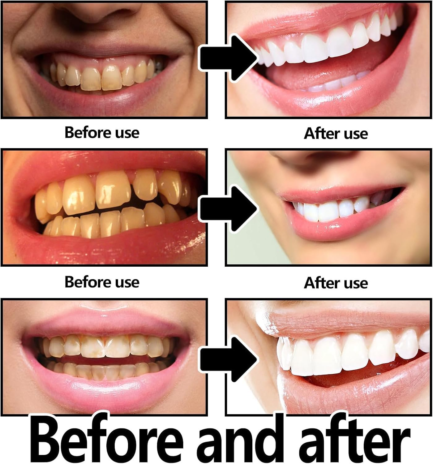 2Pcs Hydroxyapatite Toothpaste, 7.5% Nano Hydroxyapatite Toothpastes, Fluoride Free, Tooth Strengthening, Enamel Protection, Mild and Refreshing, Suitable for Sensitive Teeth, 4.23Oz image number 6