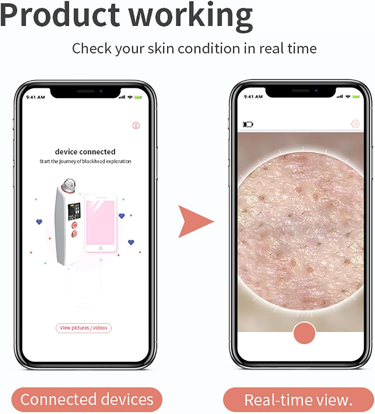 Blackhead Extractor Tool, Blackhead Instrument with 30W HD Camera, Blackhead Remover Pore Vacuum, Connect with Smartphone/4 Suction Power/4 Probes/Real-Time Skin Screen, for Salon Personal Home image number 5