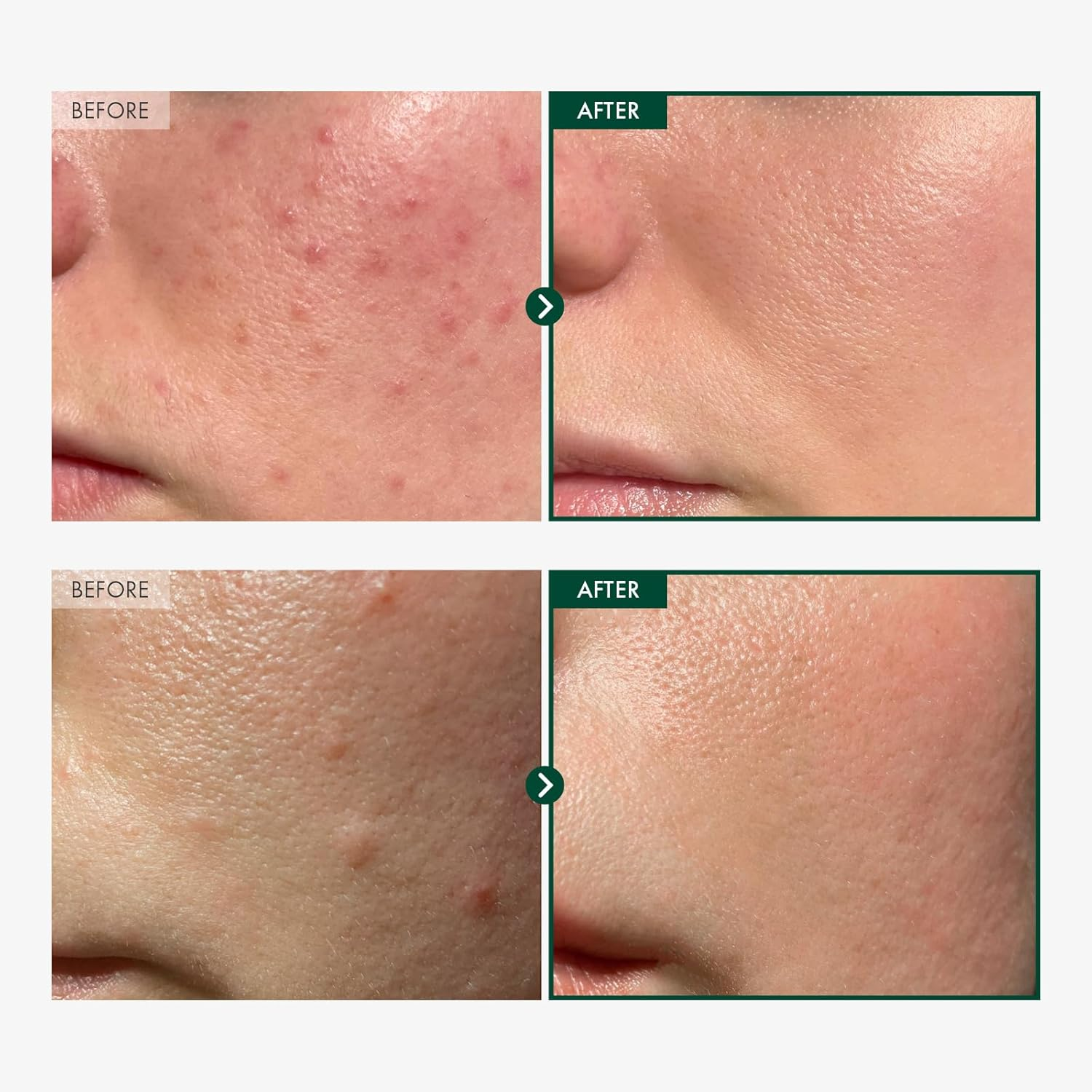 TOSOWOONG Madagascar Centella 86% Ampoule with 860,048Ppm Centella Asiatica, Soothing, Calming, Facial Serum for Face, for All Skin Types, Korean Skin Care, 100Ml, 3.38Fl.Oz. image number 4