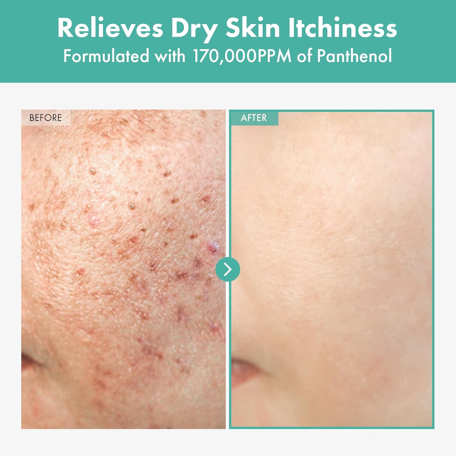 TOSOWOONG Dexpanthenol Cream, 170,000Ppm B5 Panthenol, Madecassoside, Centella Asiatica for Skin Barrier Repair, Facial Moisturizer, Soothing, Hydrating, Korean Skincare, 60Ml, 2.02 Fl. Oz. image number 4