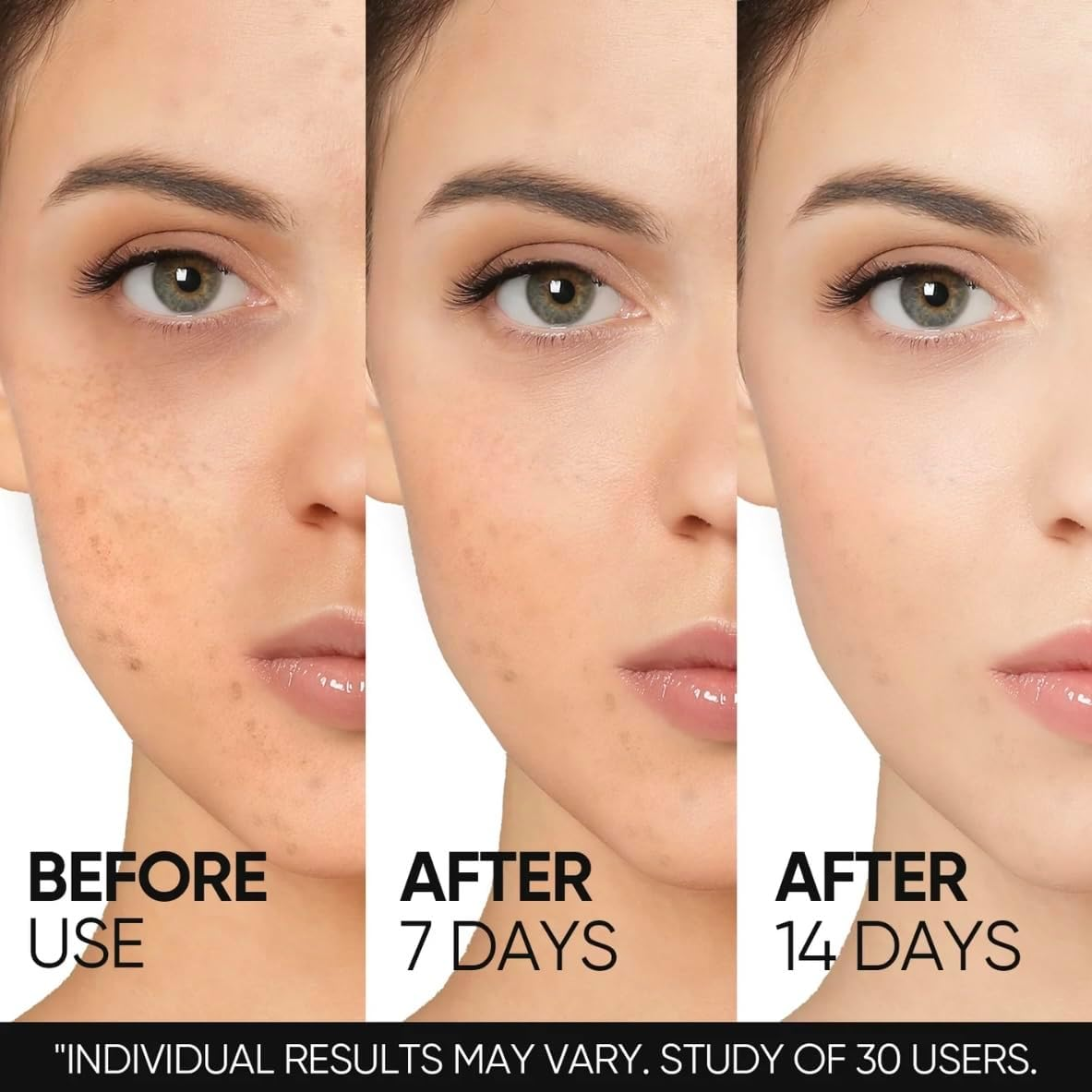 Skintific 10% Niacinamide Brightening Serum, 20Ml, Dark Spot Treatment with Alpha-Arbutin and Ceramide