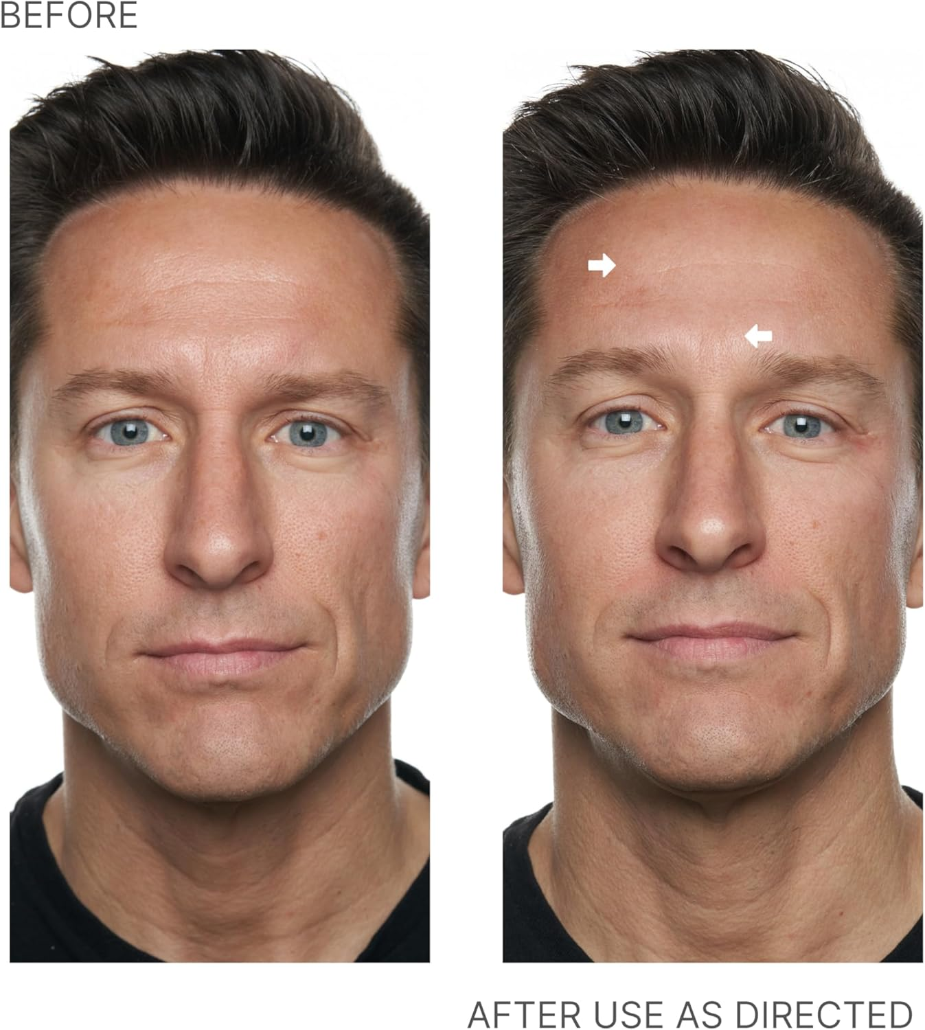 Nu Skin - Face Lift with Activator (Original Formula) | Helps Lift and Tighten Your Face and Neck for a Youthful, Firm Appearance, Reducing Lines and Wrinkles, Enhancing Skin Tone and Texture image number 3