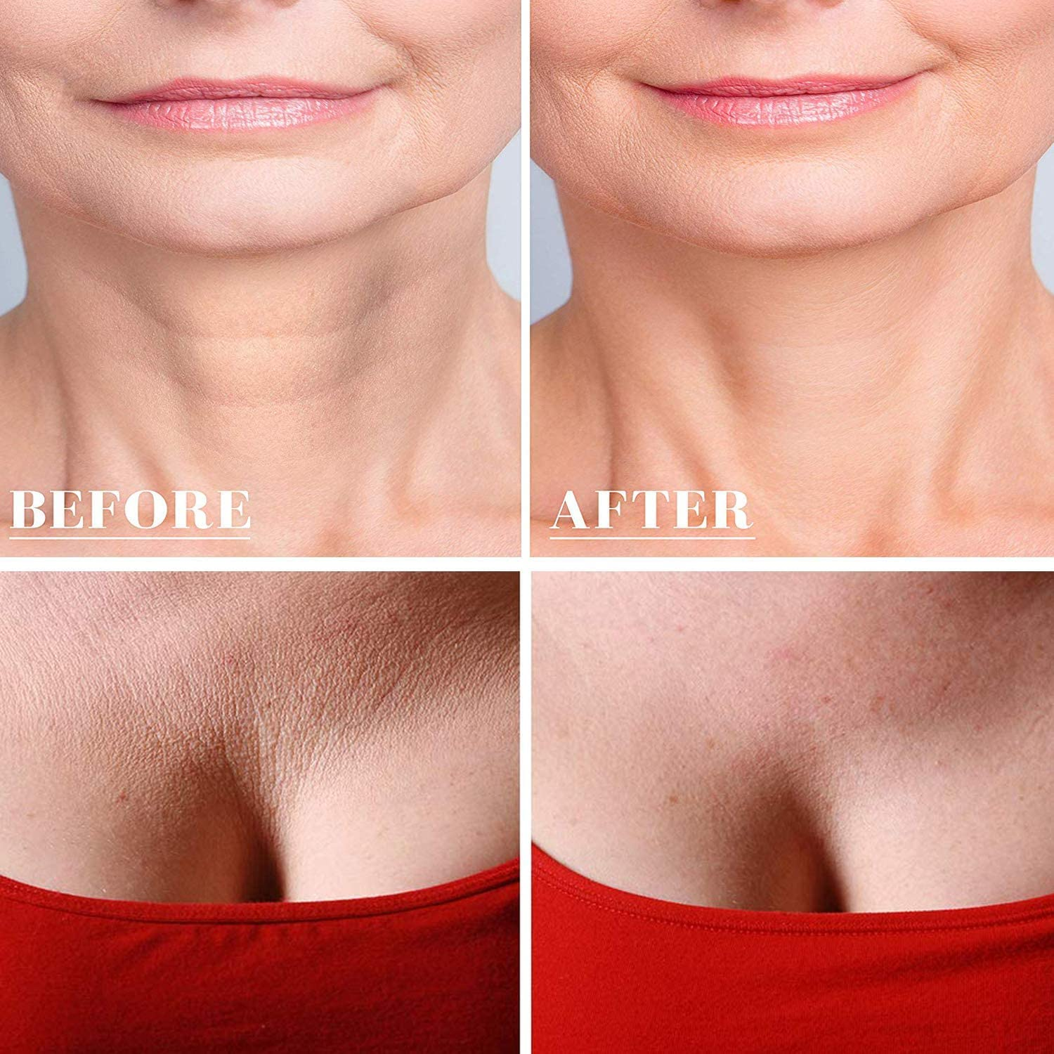 Decollete Pad for Chest Wrinkles - Set of 2 D&eacute;collet&eacute; Pads for Chest and Neck Wrinkles Prevention - Reusable Medical Grade Overnight anti Wrinkle Patches image number 5