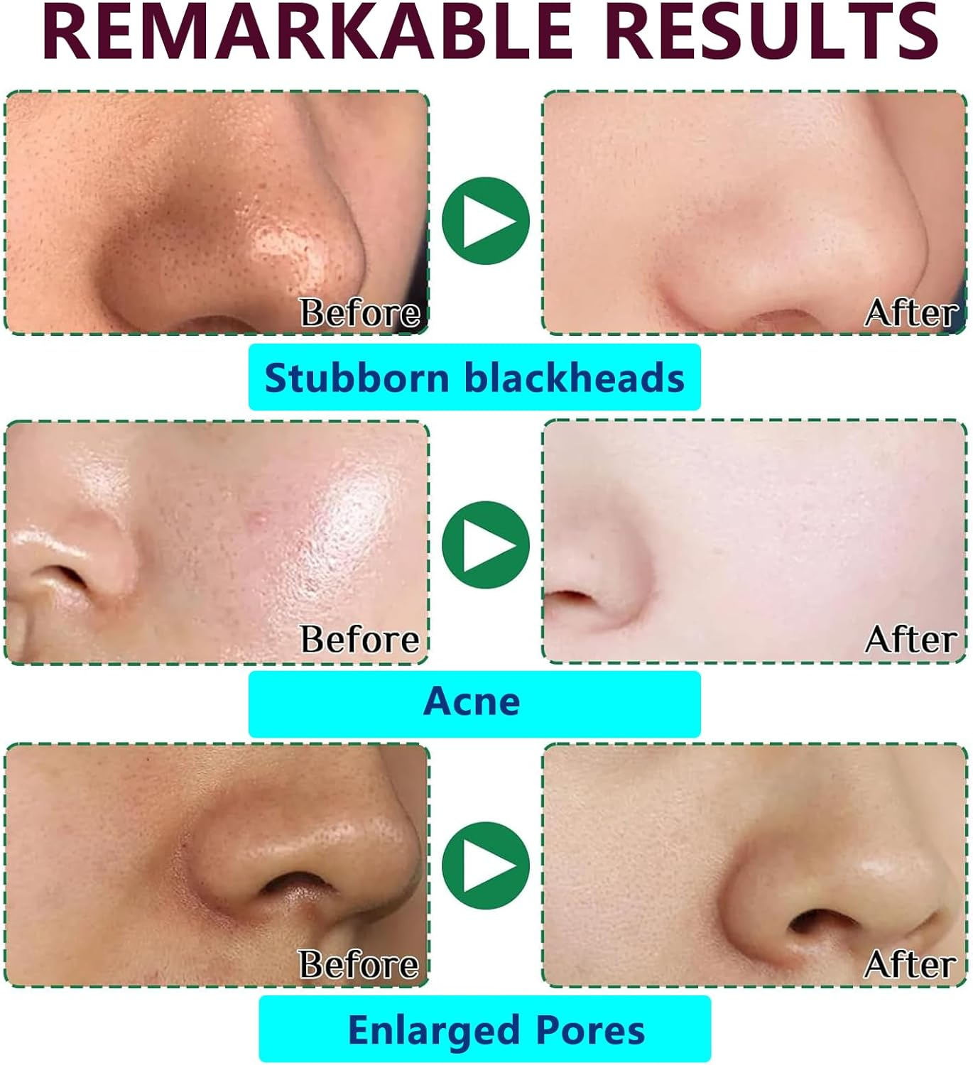 RAXSEG Blackhead Pore Strips, Black Head Remover for Face, Deep Cleansing Nose Blackhead with Instant Pore Unclogging, Oil-Free, image number 4