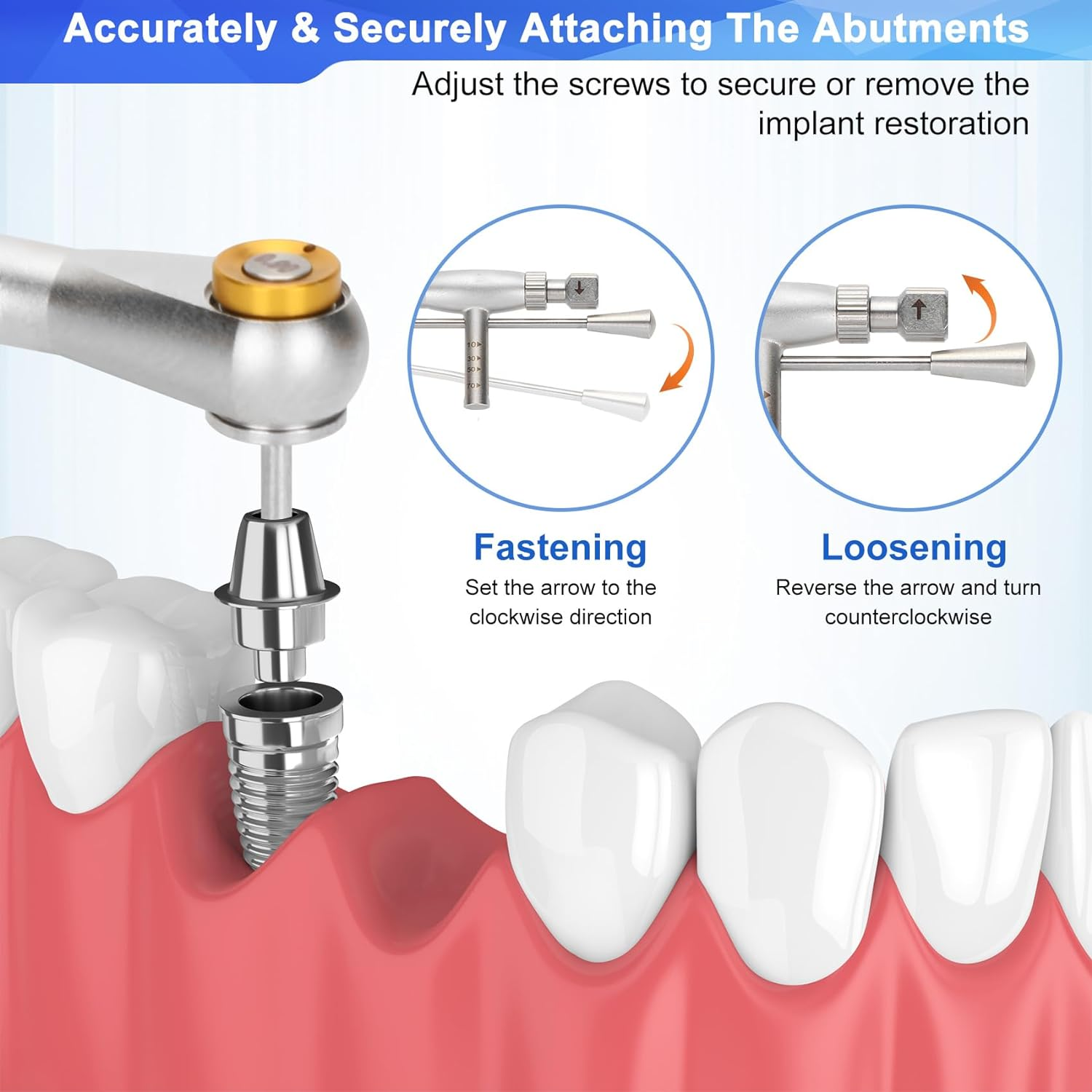 Dental Implant Torque Wrench Set Universal Prosthetic Kit Dental Implant Kit with Torque Adjustable Ratchet Screwdrivers 16Pcs, Fully Autoclavable,10-70Ncm, Secure/Disassemble Implant Restorations image number 2