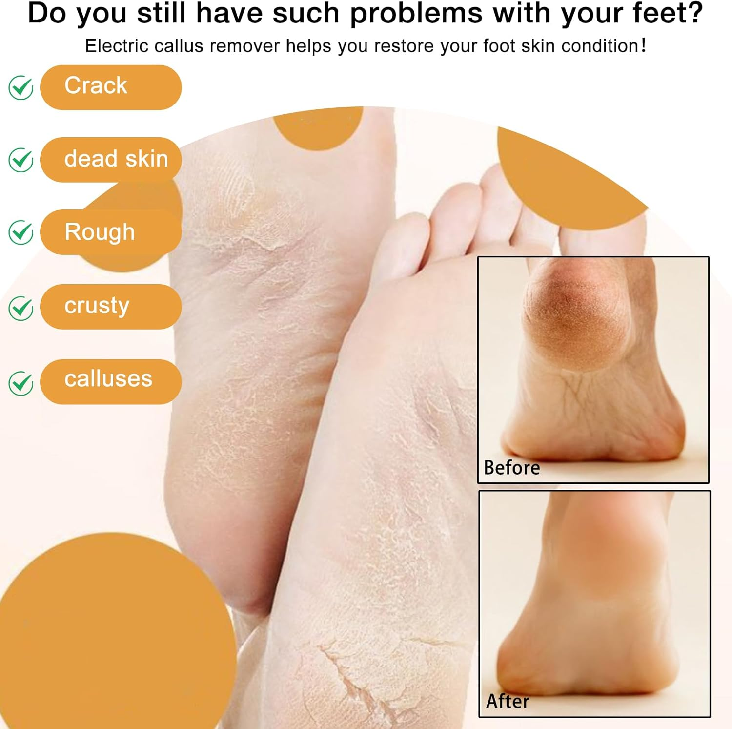 Electric Foot Callus Remover, 2024 New USB Rechargeable Foot Repair and Grinding Device, Heel Polisher Digital Display, Electric Foot Exfoliating Scrubber with 3 Grinding Heads 2 Speeds (Blue) image number 3