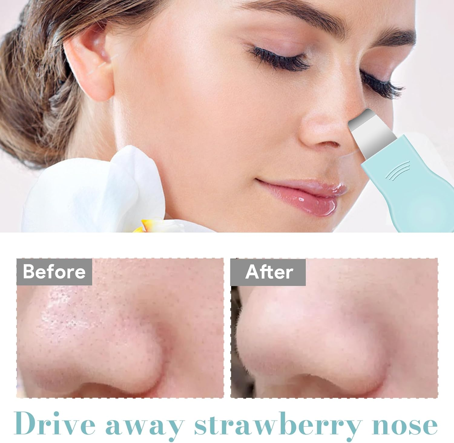 Blackhead Remover Tool &ndash; Dual-Head Pore Scraper for Deep Cleansing, Gentle & Painless Nose Scraper, Skin Scrubber Face Spatula with Protective Cap, Safe & Made from Silicon image number 4