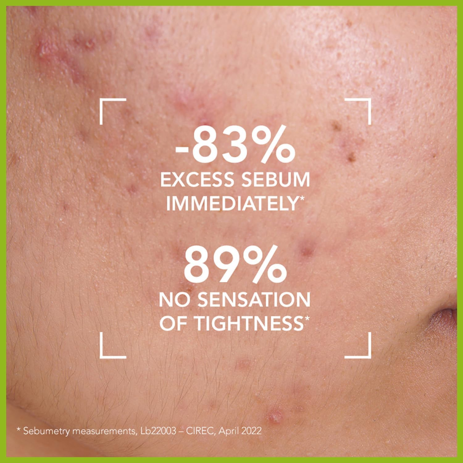 Bioderma - S&egrave;bium - Gel Moussant - Foaming Gel Purifying Face Cleanser for Oily Skin, 200Ml image number 6