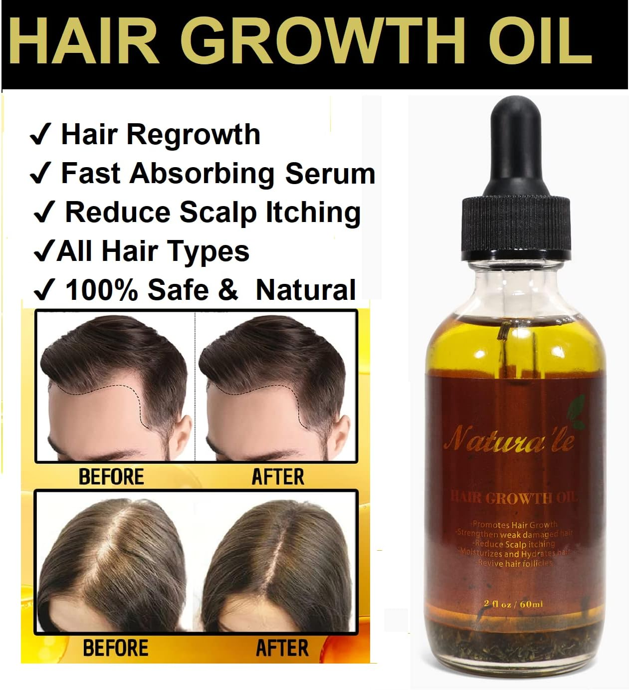 Hair Growth Oil anti Hair Loss Oil for Thin, Bald Hair Prone to Breakage Scalp Dry Hair Loss Hair Peppermint 60Ml image number 1