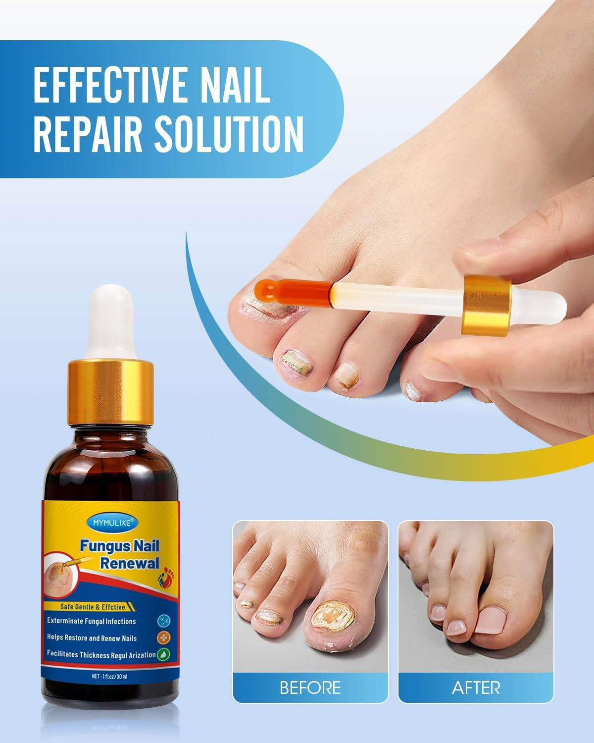 MYMULIKE Nail Repair, Nail Renewal Liquid, Extra Strength Nail Solution for Damaged and Discoloured Nails Fast Acting for Woman and Man image number 4