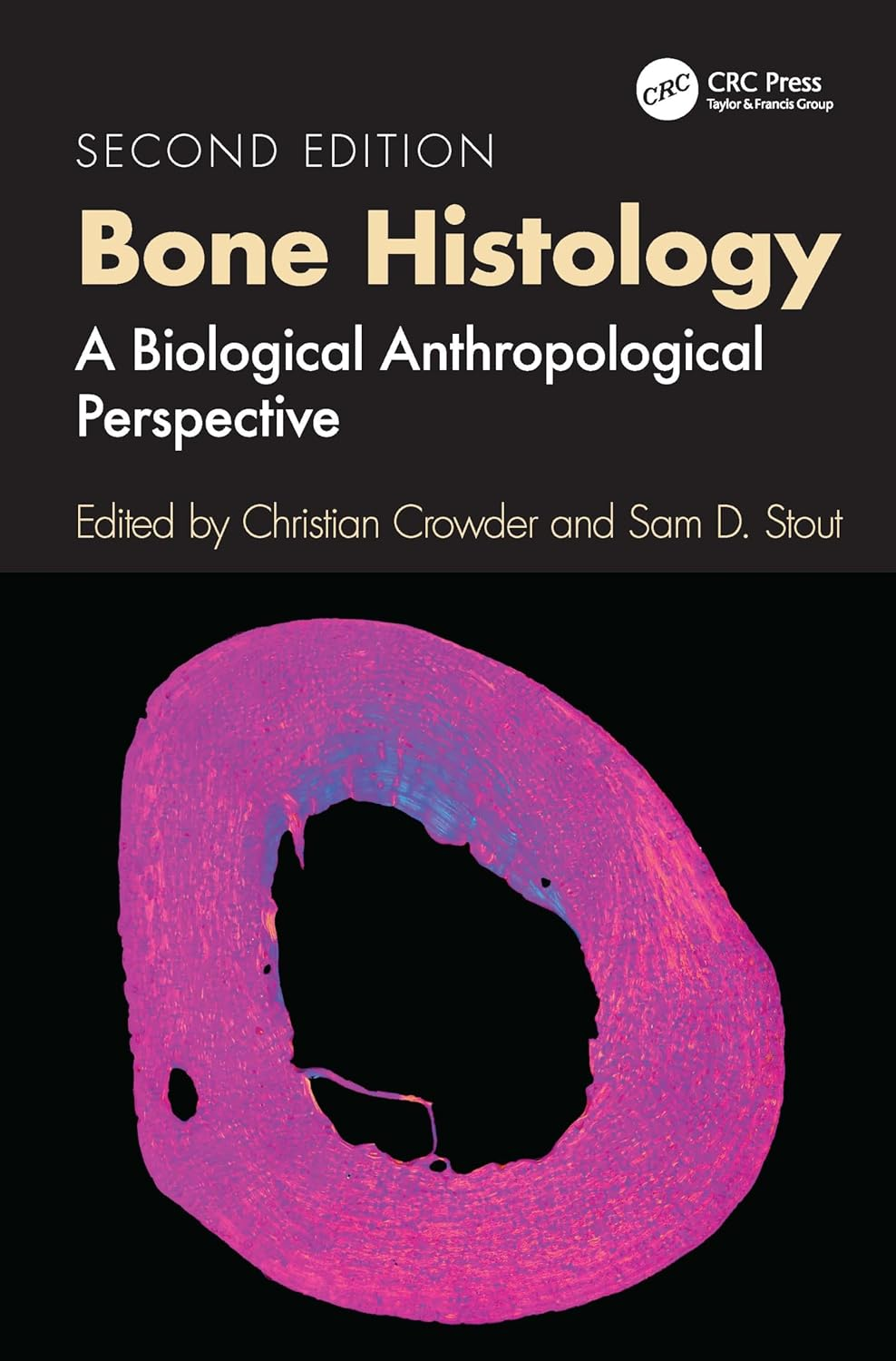 Bone Histology: a Biological Anthropological Perspective